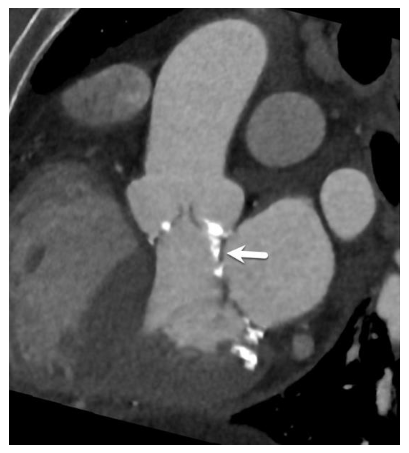 Diagnostics 15 00097 g007 Diagnostics 15 00097 g007