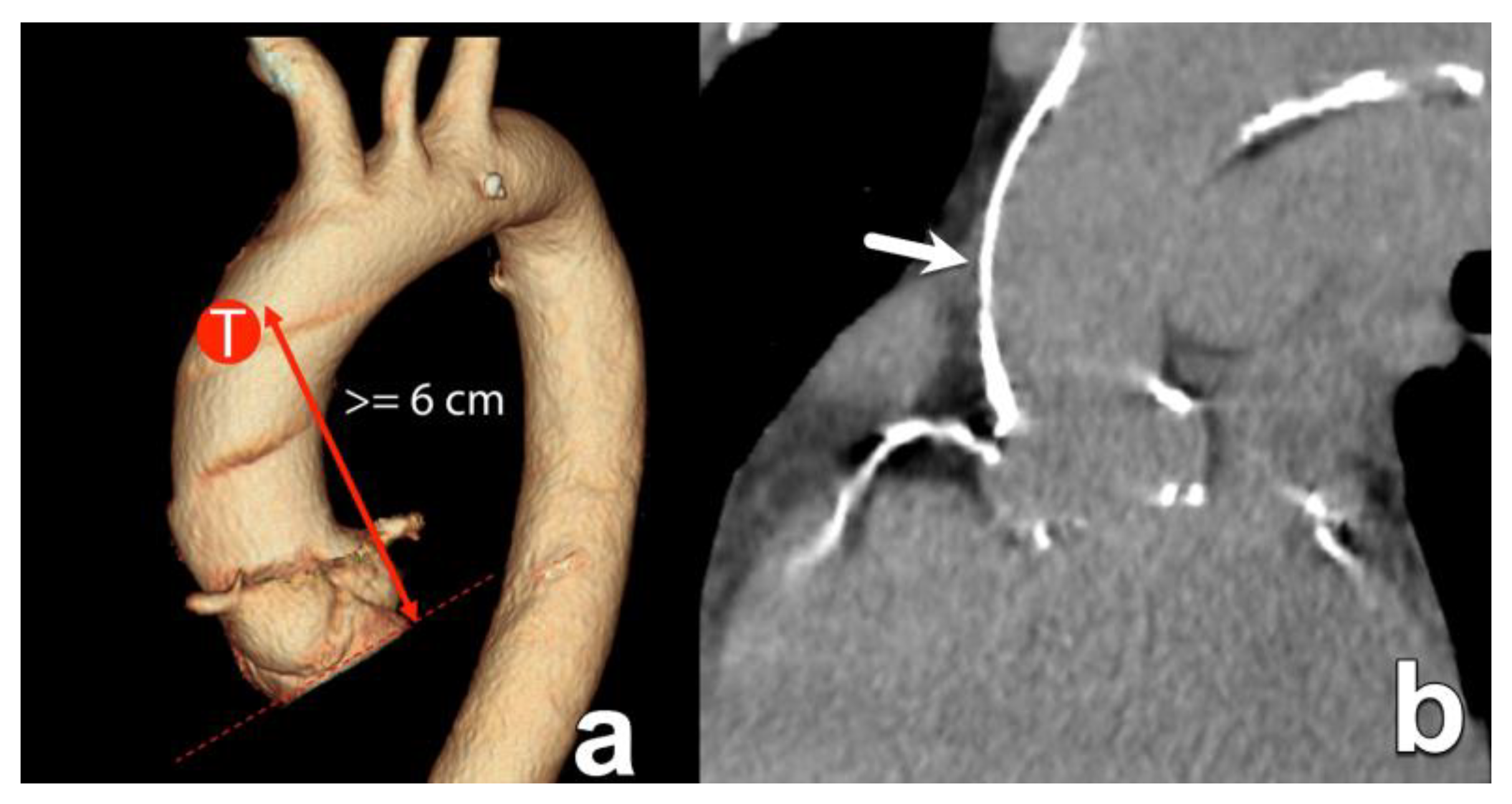 Diagnostics 15 00097 g009 Diagnostics 15 00097 g009