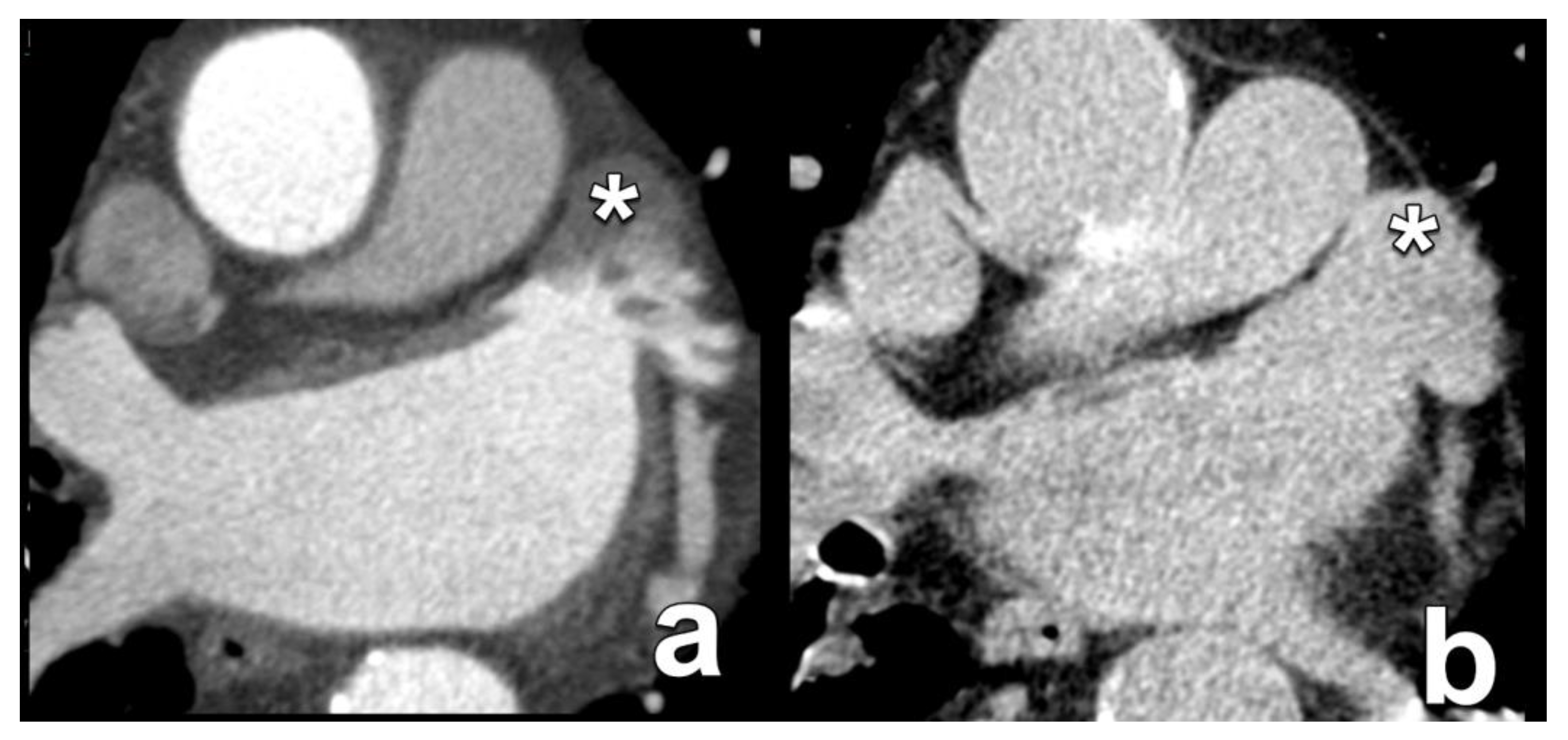 Diagnostics 15 00097 g012 Diagnostics 15 00097 g012