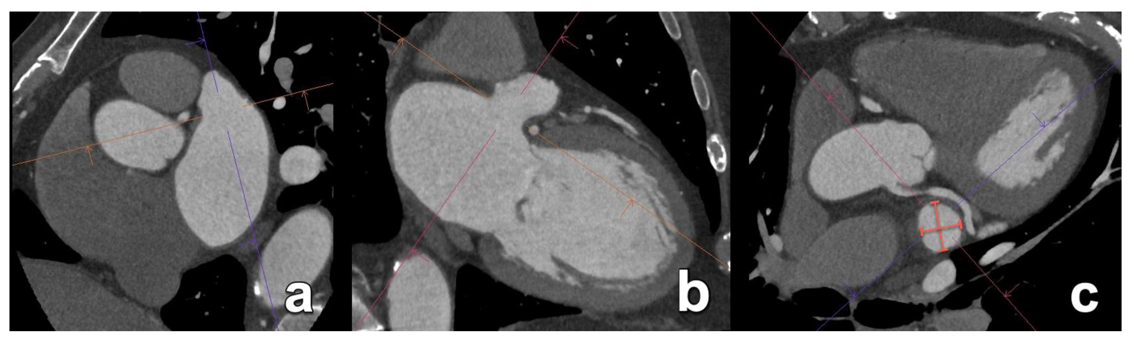 Diagnostics 15 00097 g013 Diagnostics 15 00097 g013