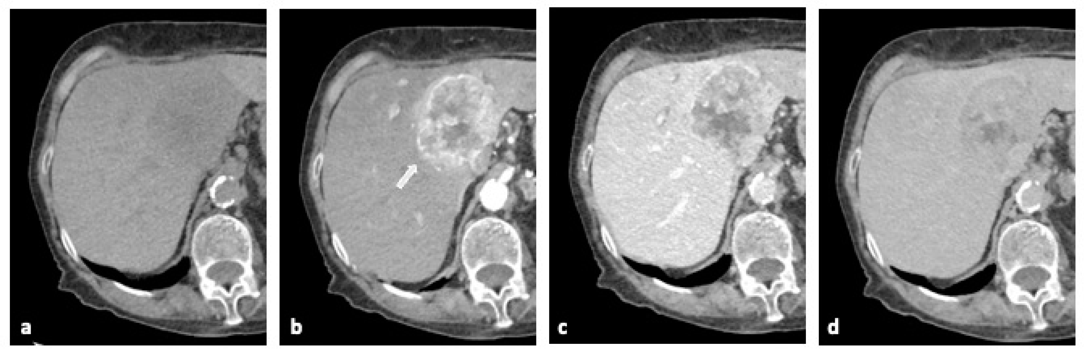 Diagnostics 15 00148 g002