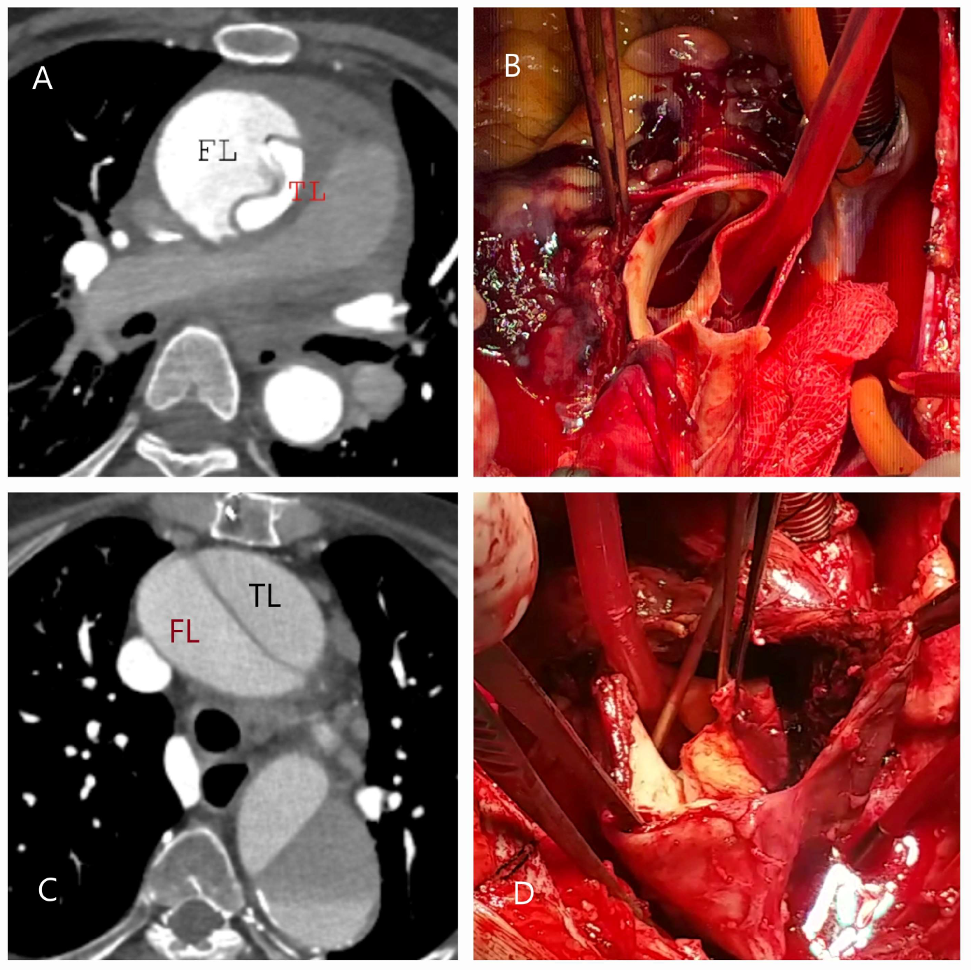 Diagnostics 15 00183 g003
