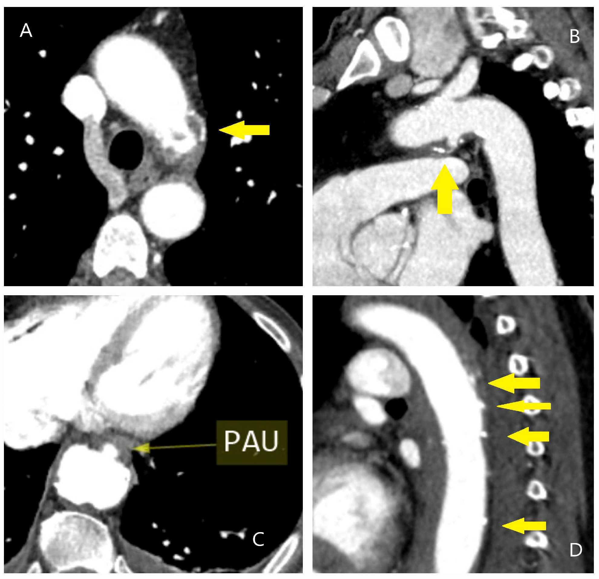 Diagnostics 15 00183 g007