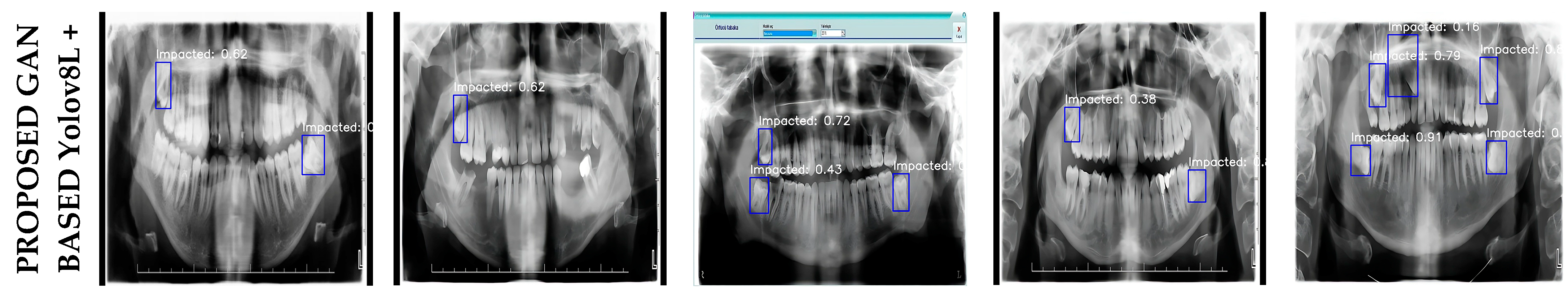 Diagnostics 15 00244 g003b