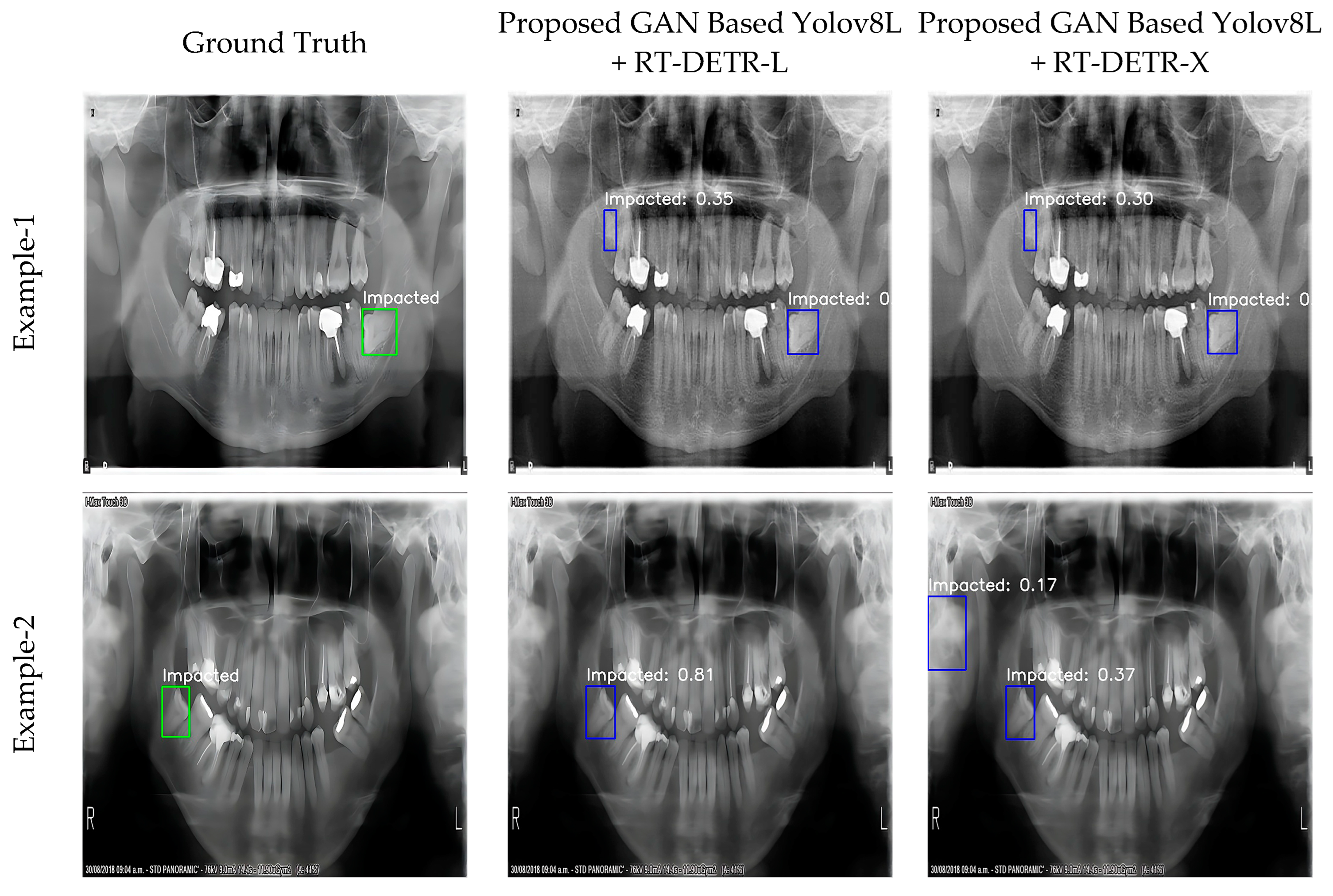 Diagnostics 15 00244 g004