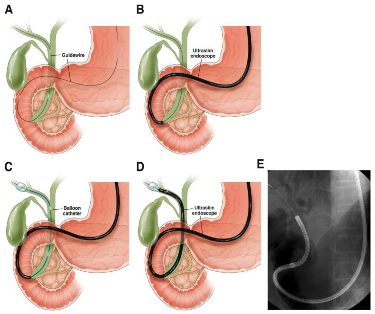 Diagnostics 15 00325 g003