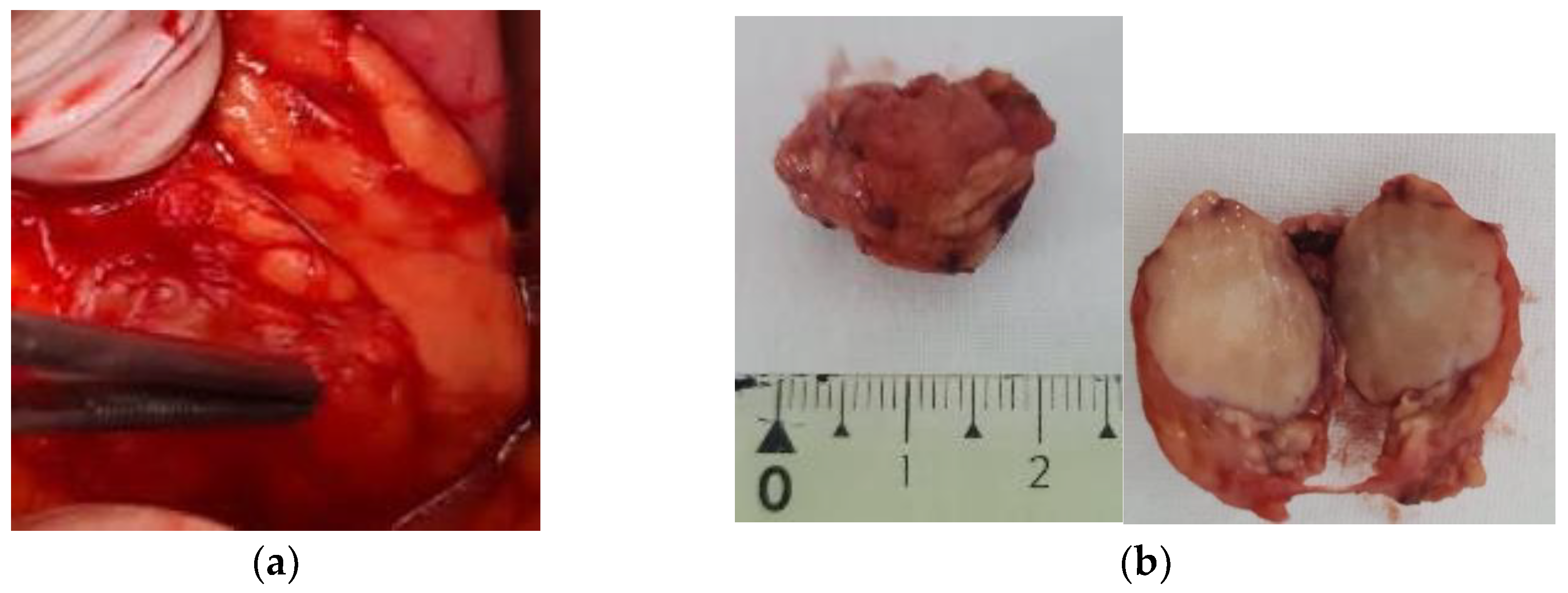 Diagnostics 15 00337 g002 Diagnostics 15 00337 g002