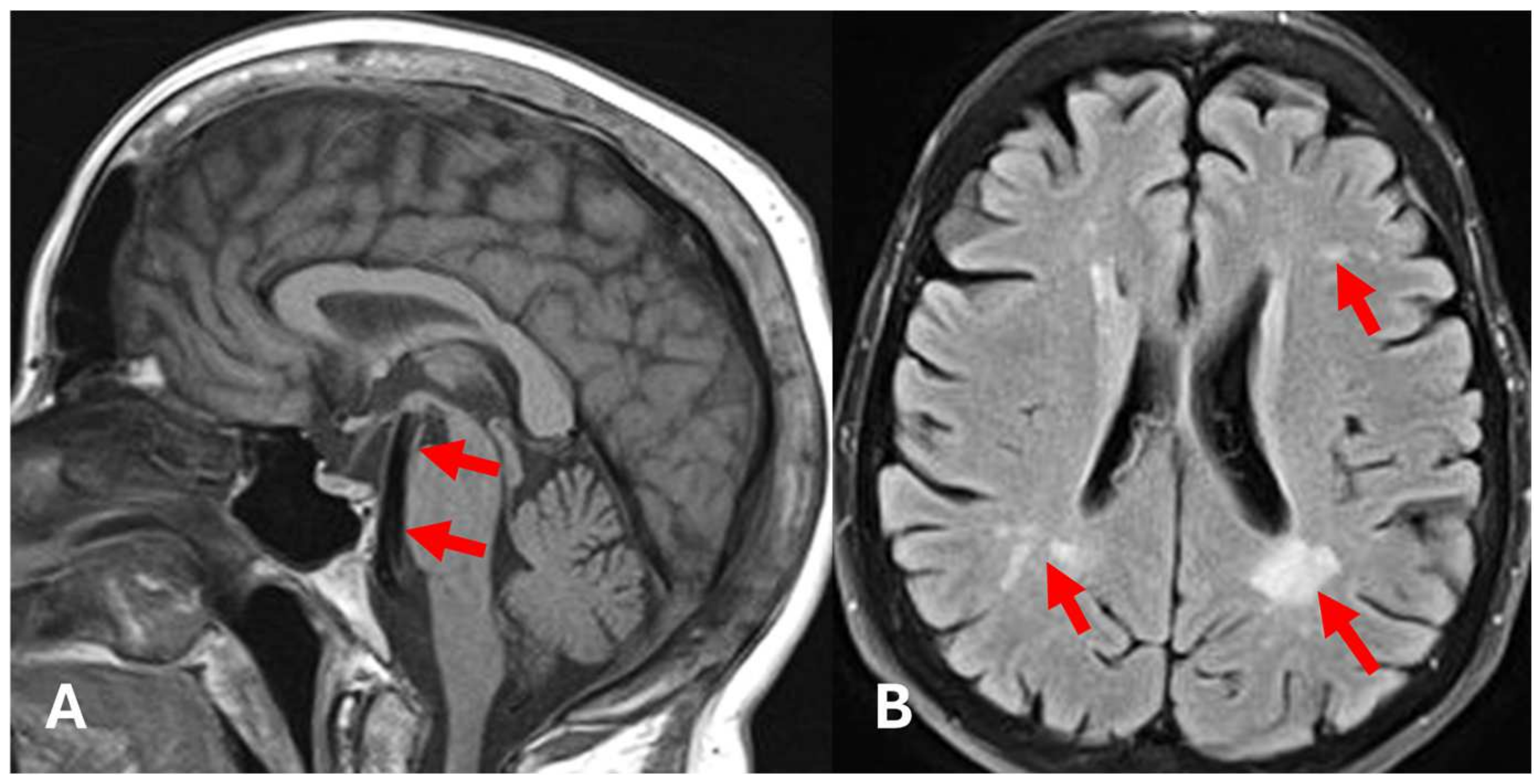 Diagnostics 15 00340 g004