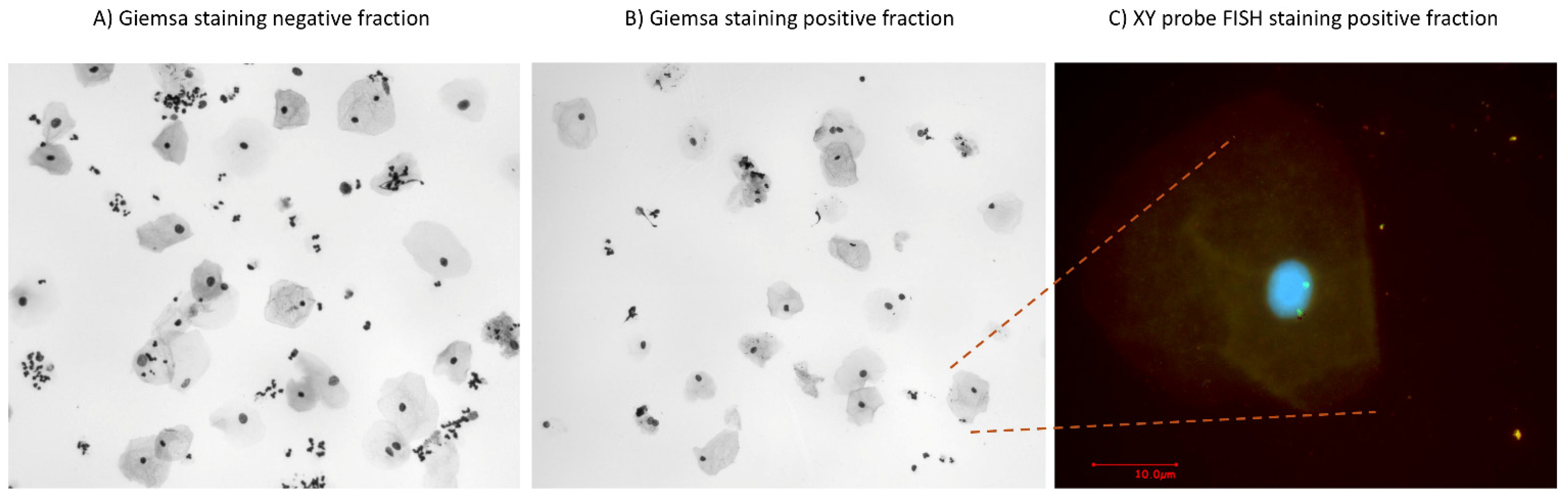 Diagnostics 15 00386 g004