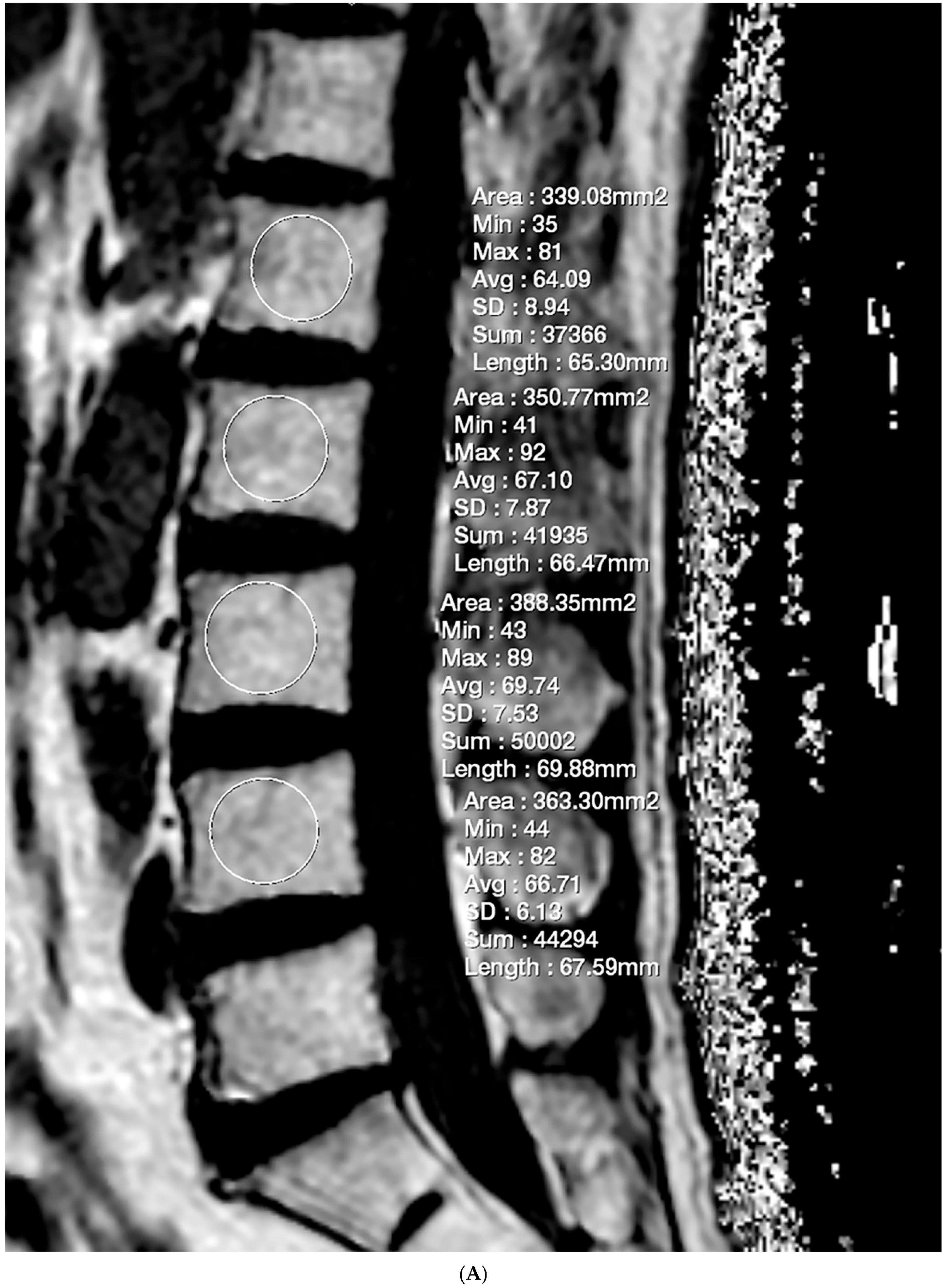 Diagnostics 15 00503 g001a