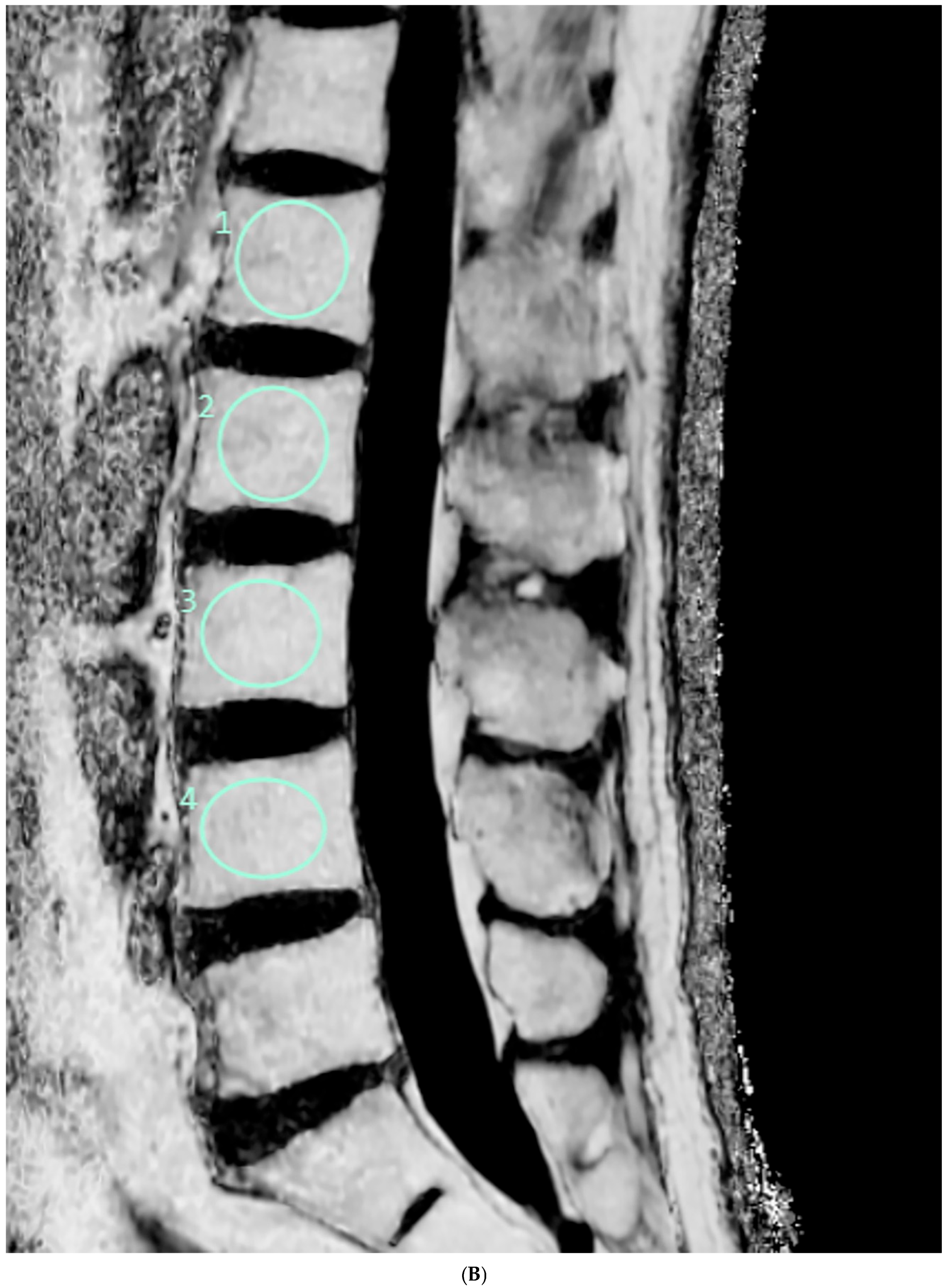 Diagnostics 15 00503 g001b