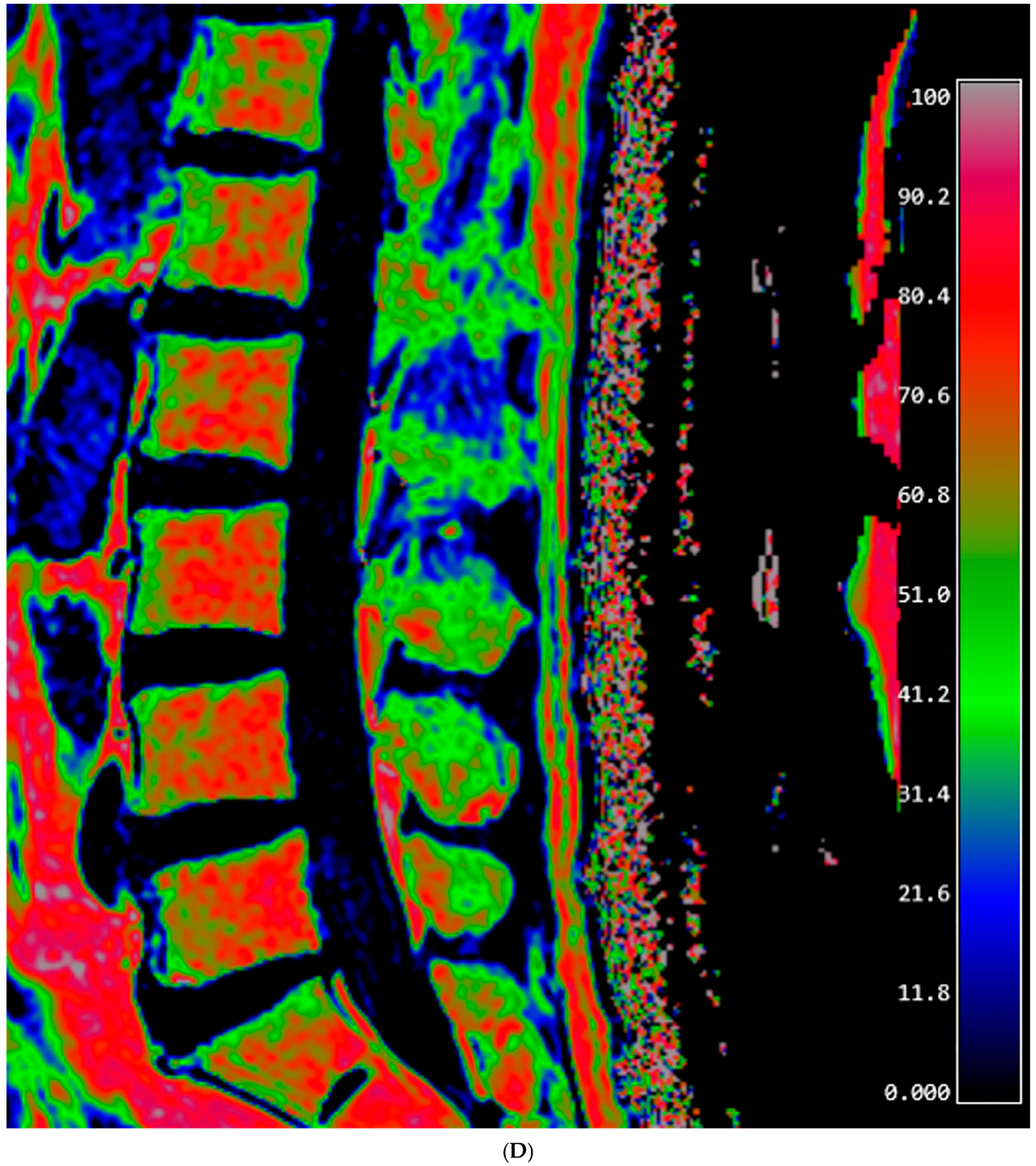 Diagnostics 15 00503 g001d