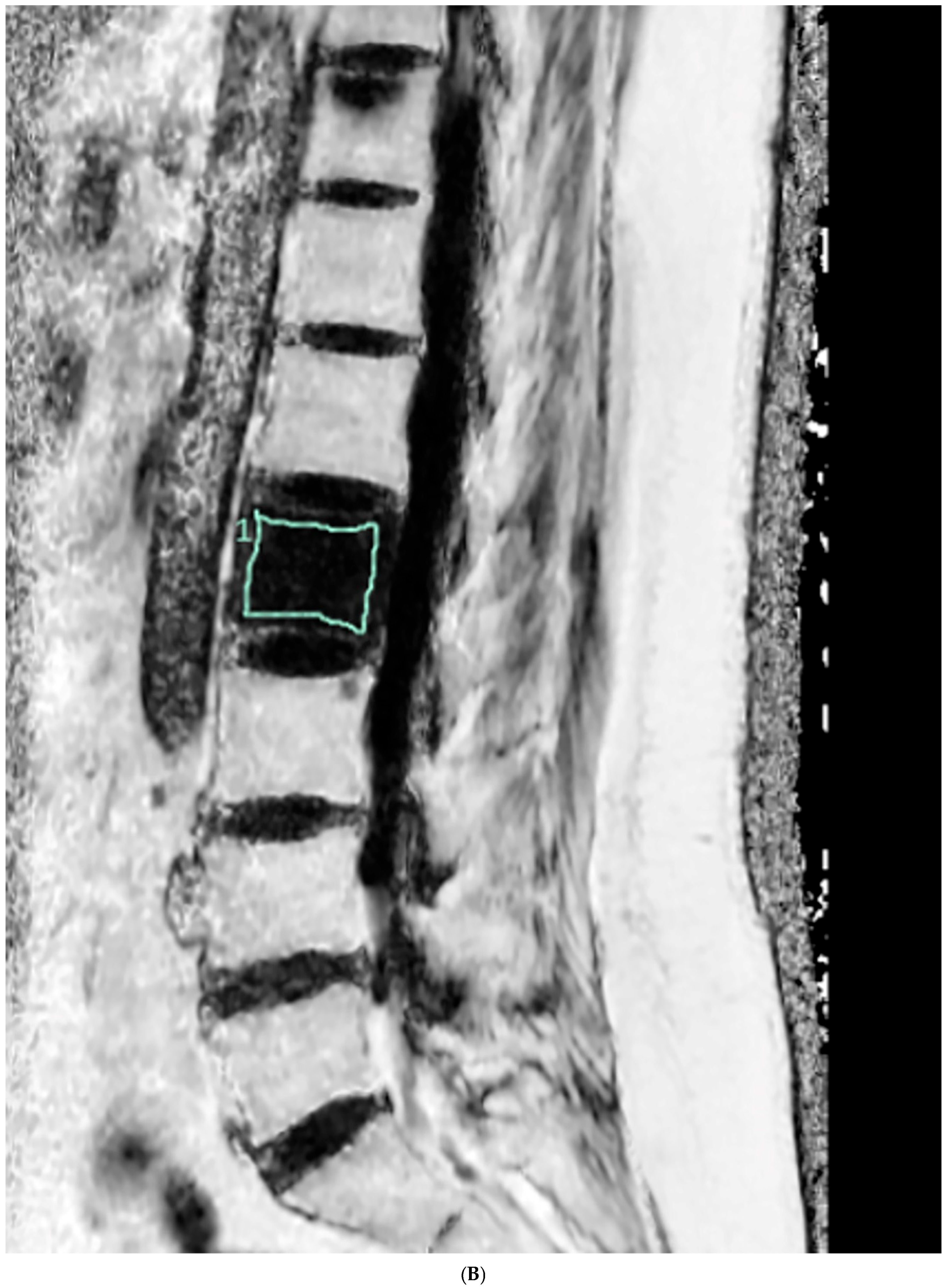 Diagnostics 15 00503 g002b