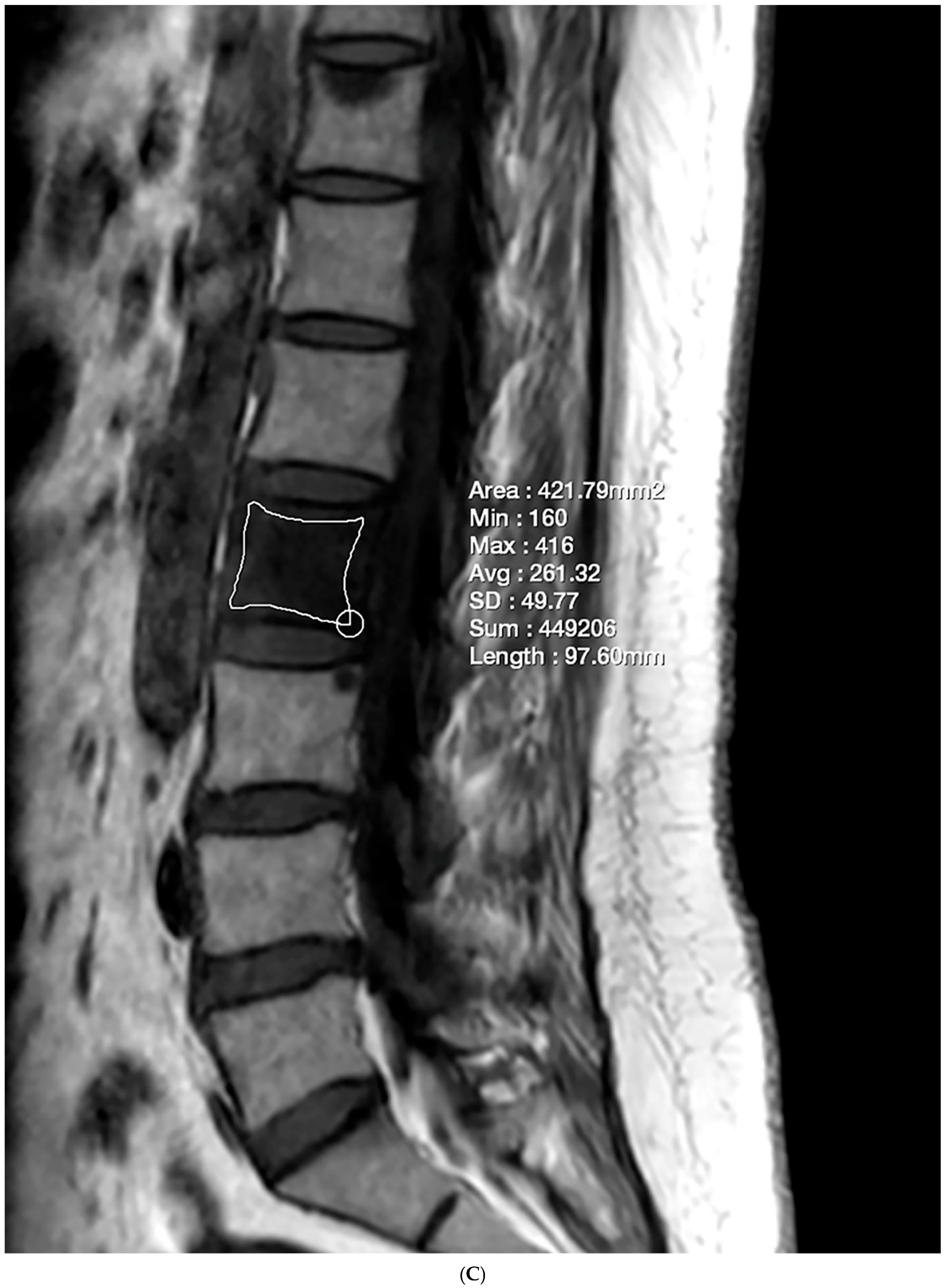 Diagnostics 15 00503 g002c