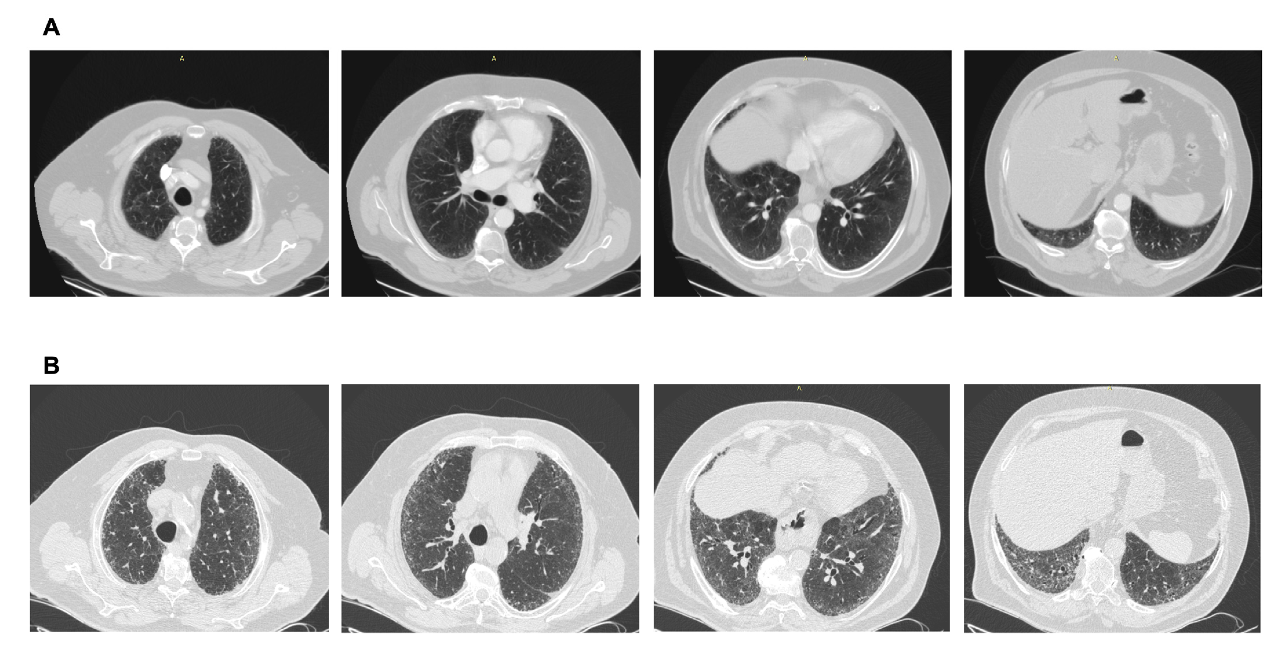 Diagnostics 15 00509 g003