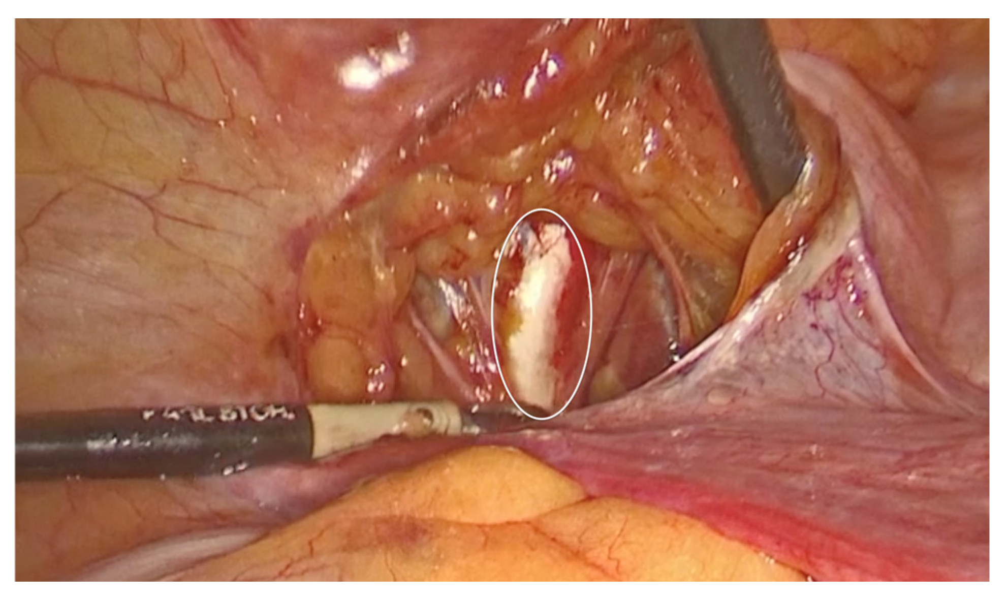 Diagnostics 15 00526 g004