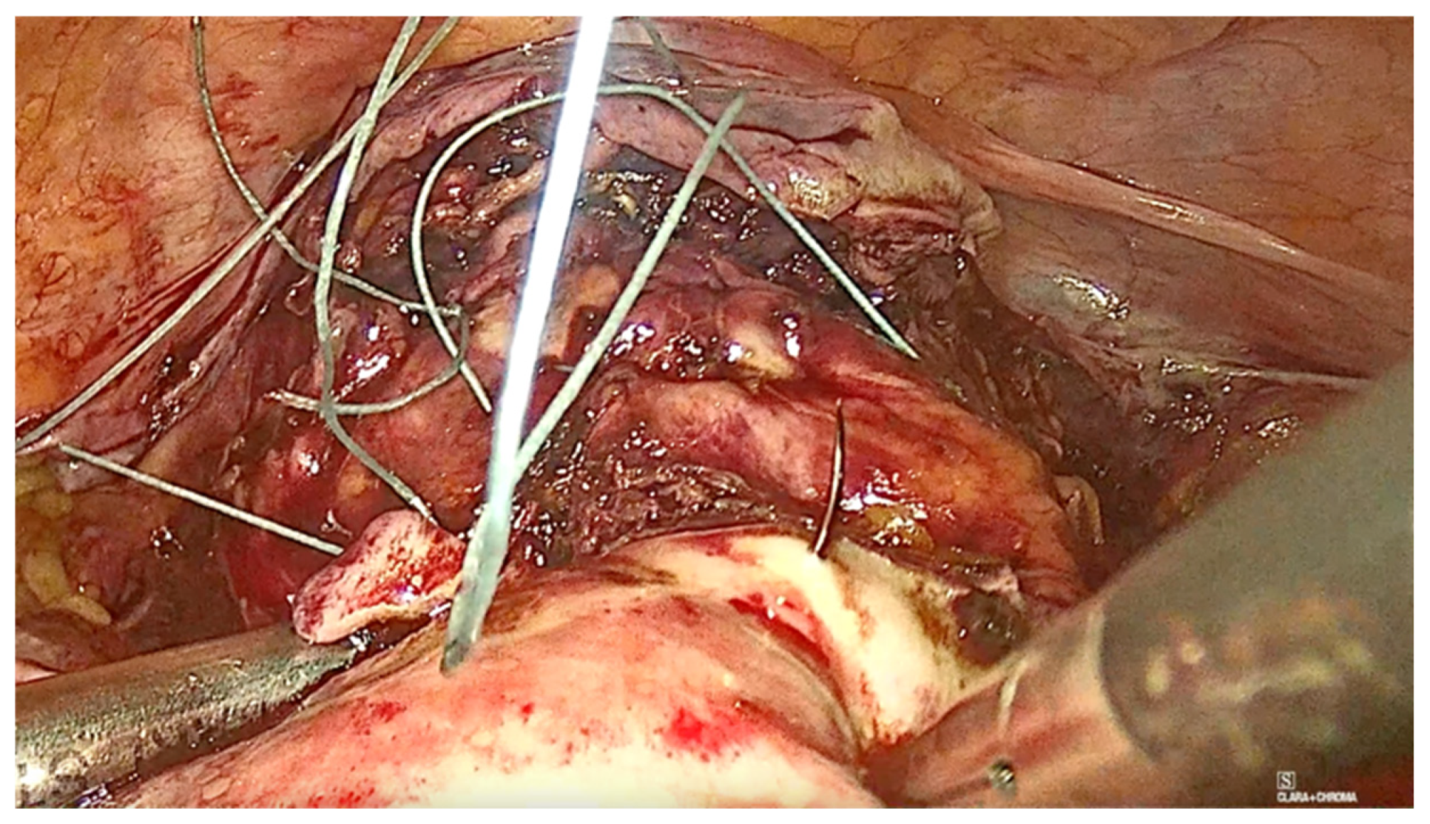 Diagnostics 15 00526 g008