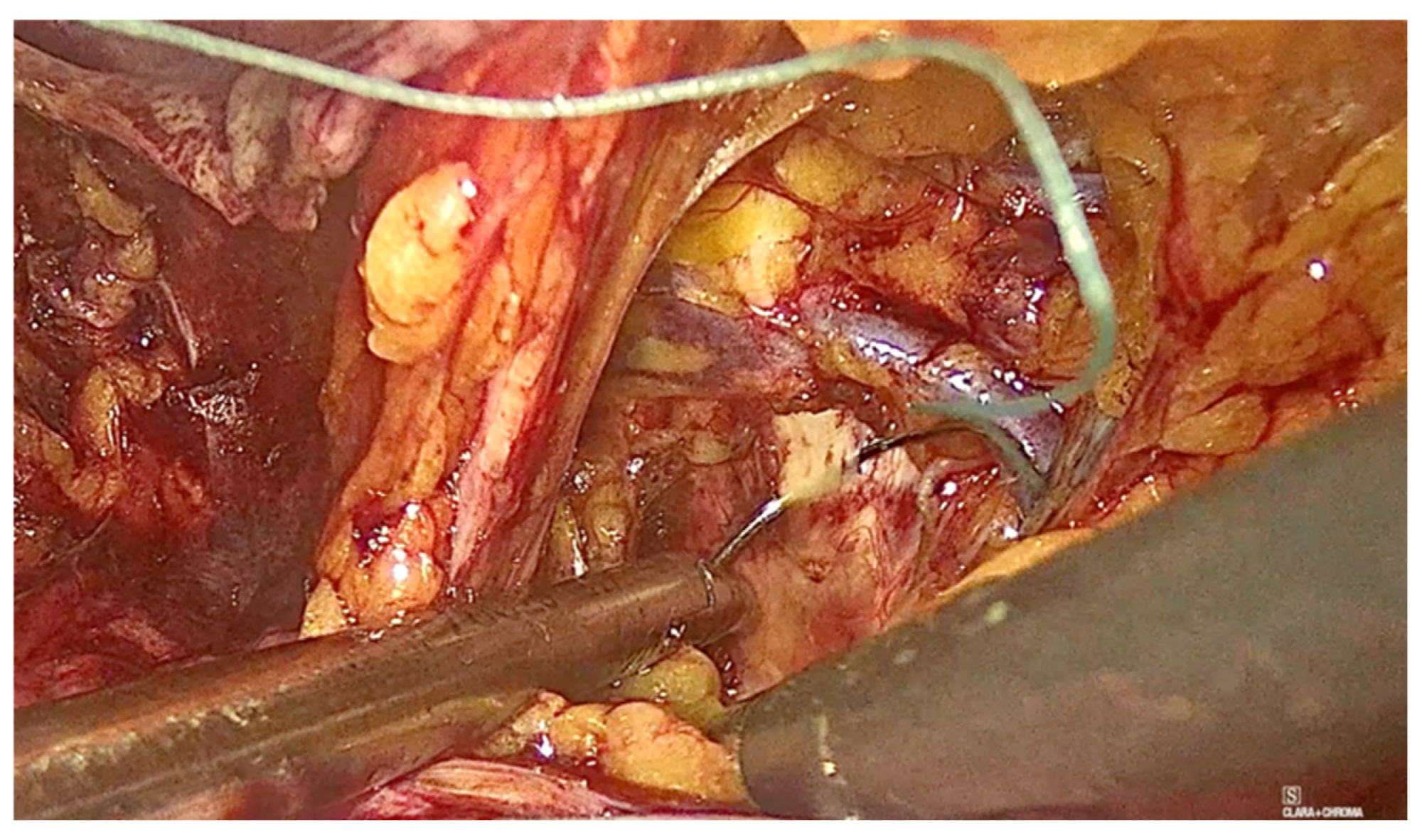 Diagnostics 15 00526 g009