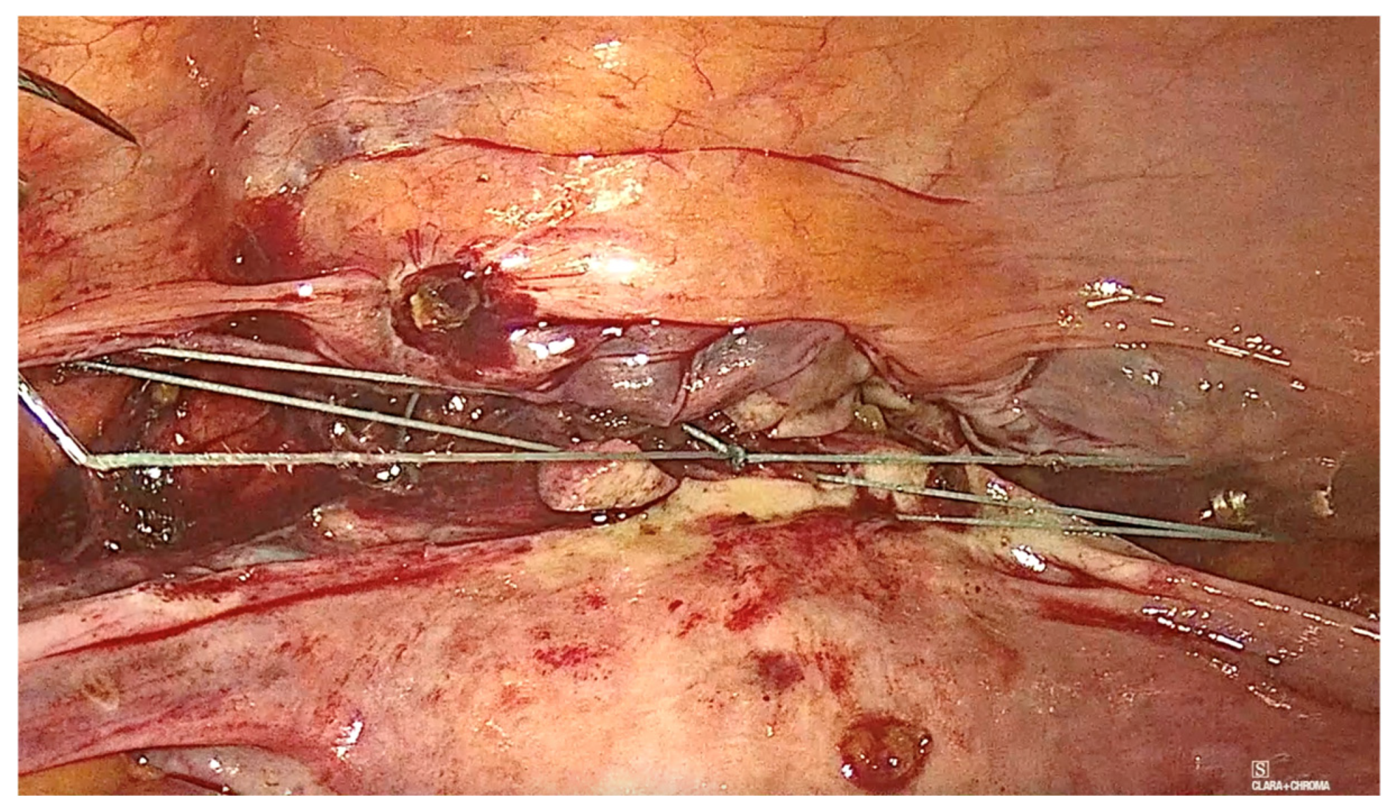 Diagnostics 15 00526 g011