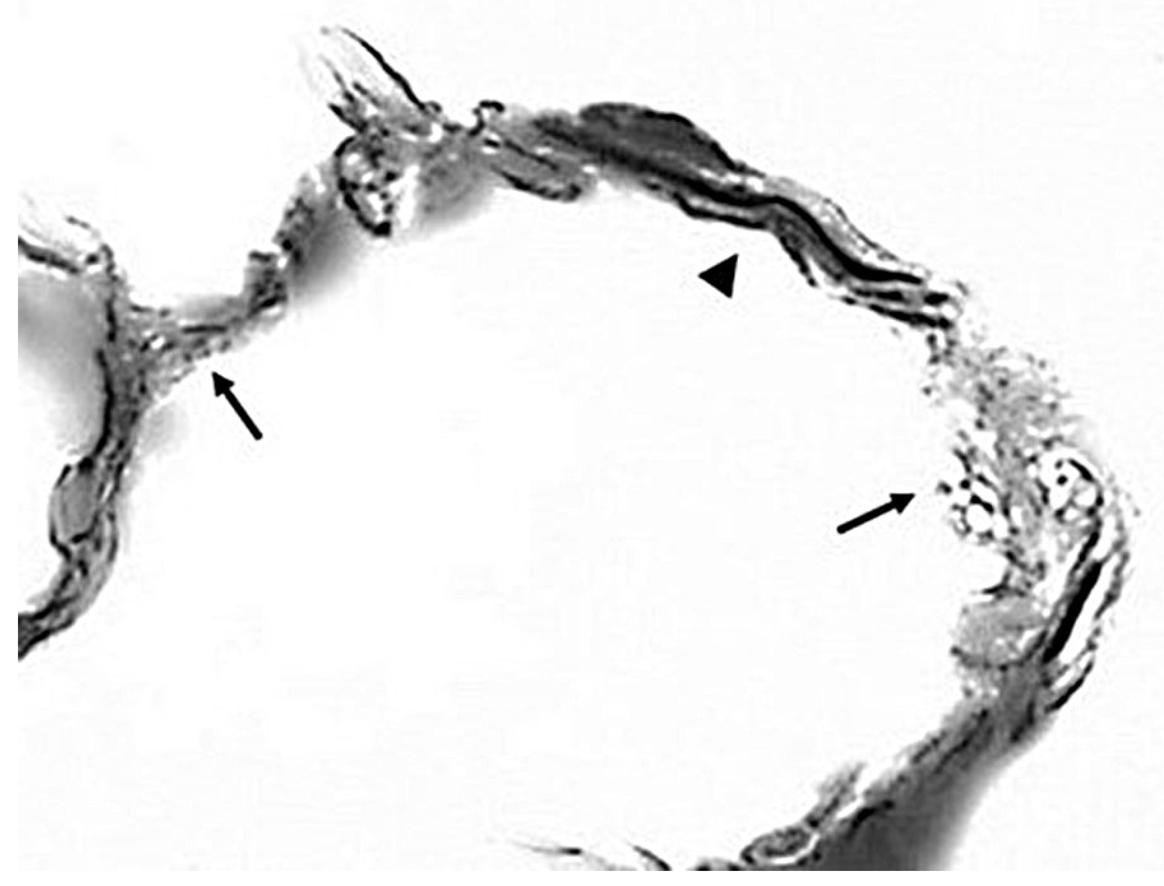 Diagnostics 15 00578 g003 Diagnostics 15 00578 g003