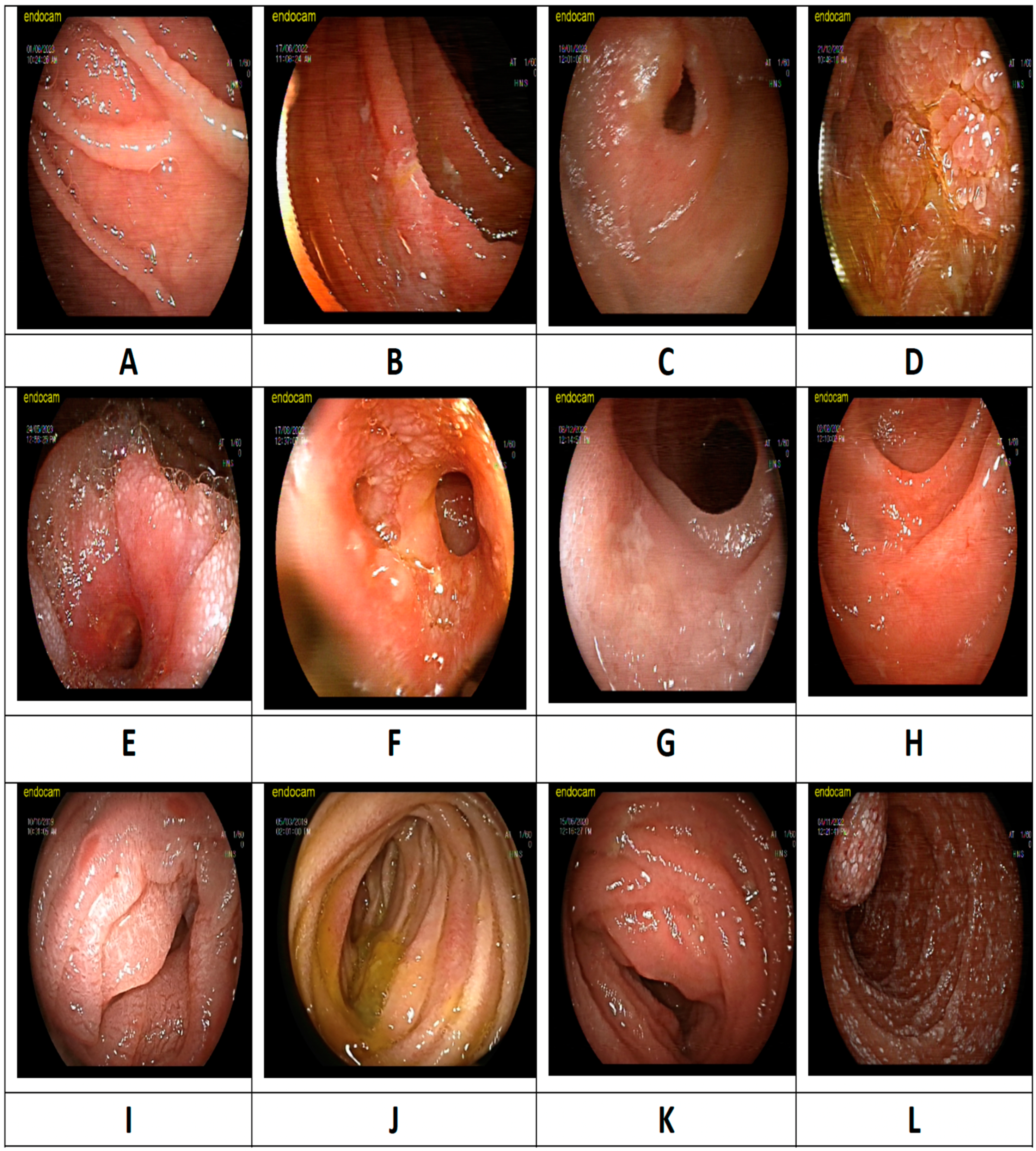 Diagnostics 15 00661 g002