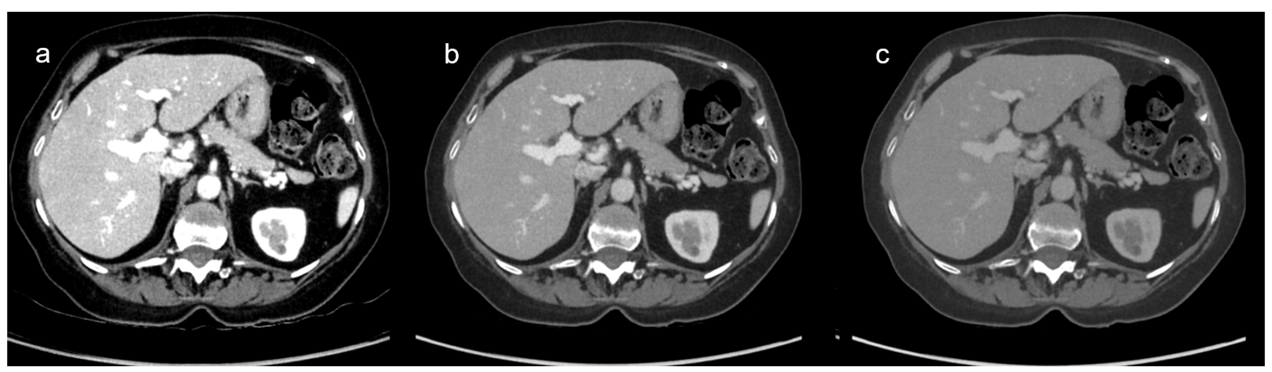 Diagnostics 15 00707 g002