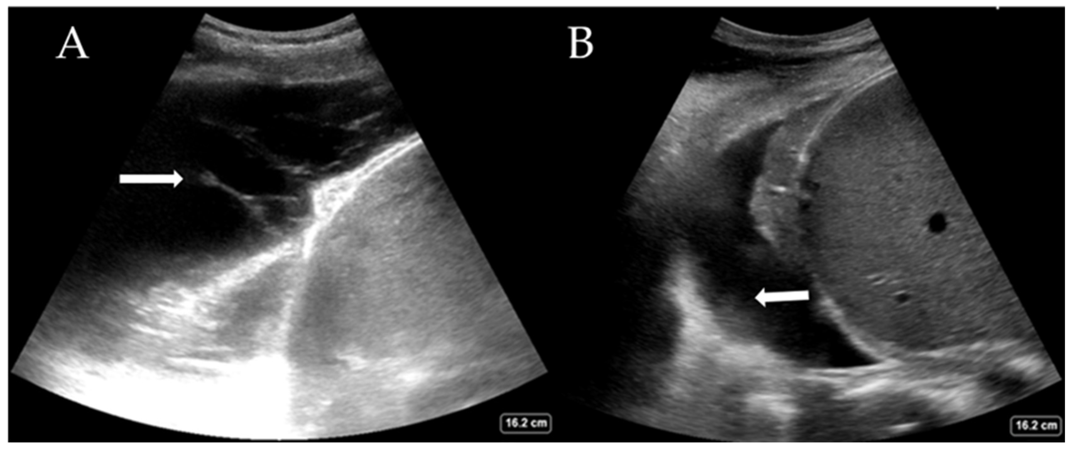 Diagnostics 15 00755 g003 Diagnostics 15 00755 g003