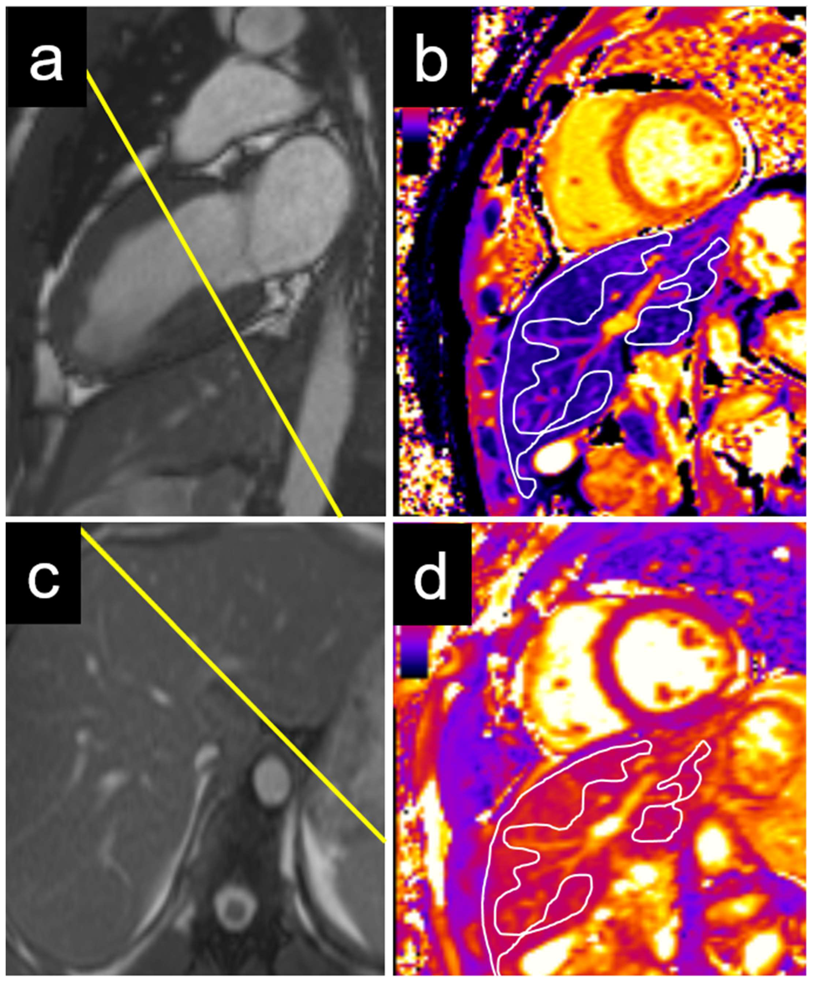 Diagnostics 15 00779 g003