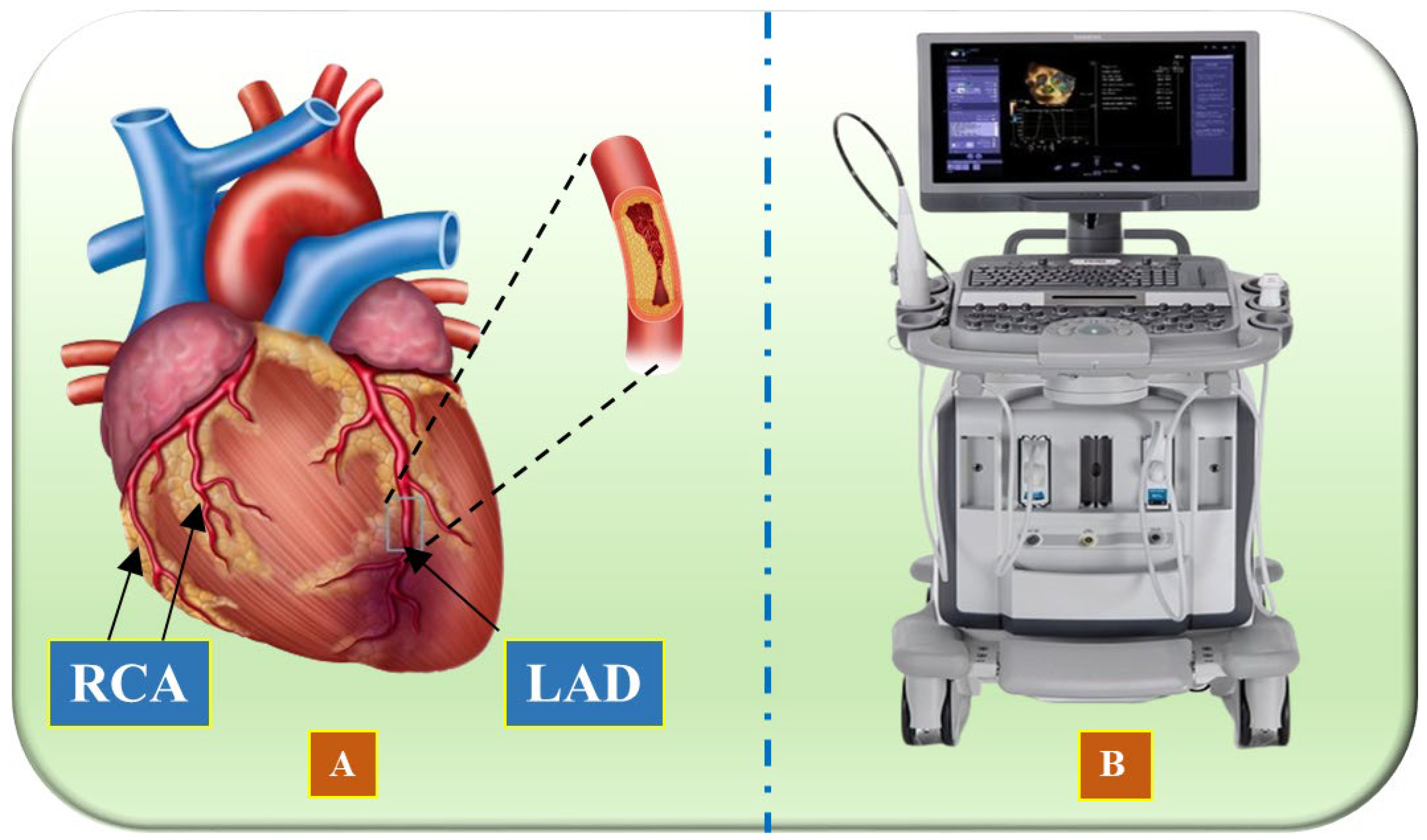 Diagnostics 15 00848 g001