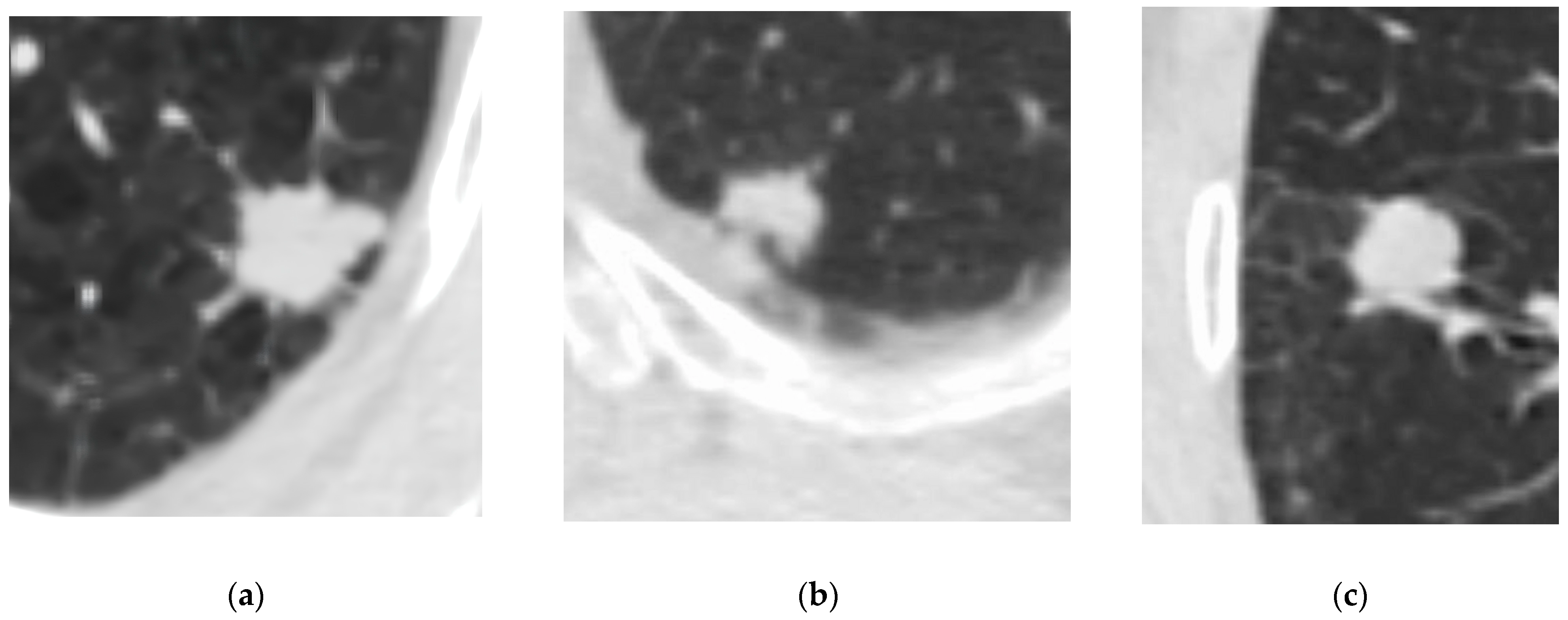 Diagnostics 15 00874 g001