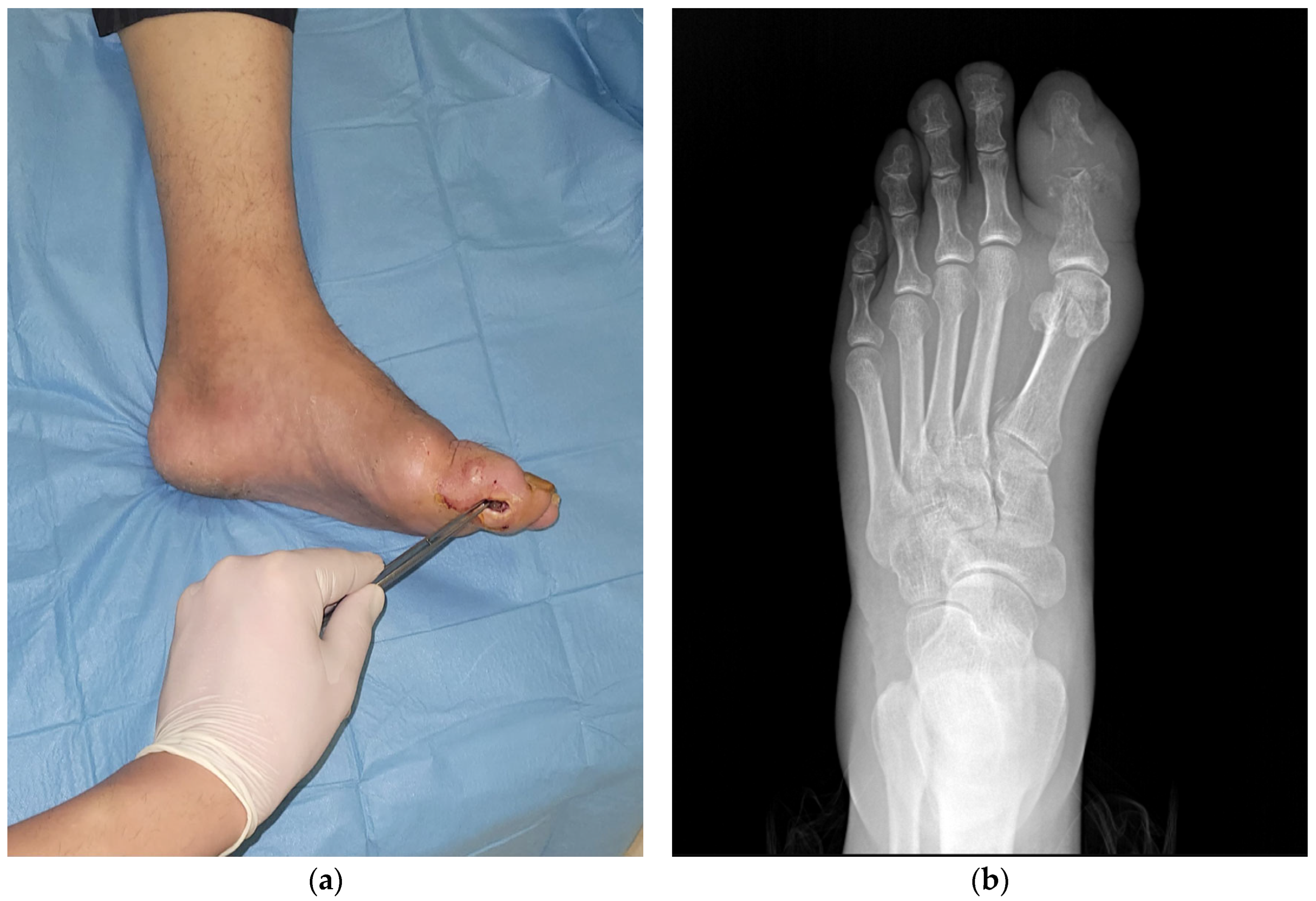 Diagnostics 15 00880 g001