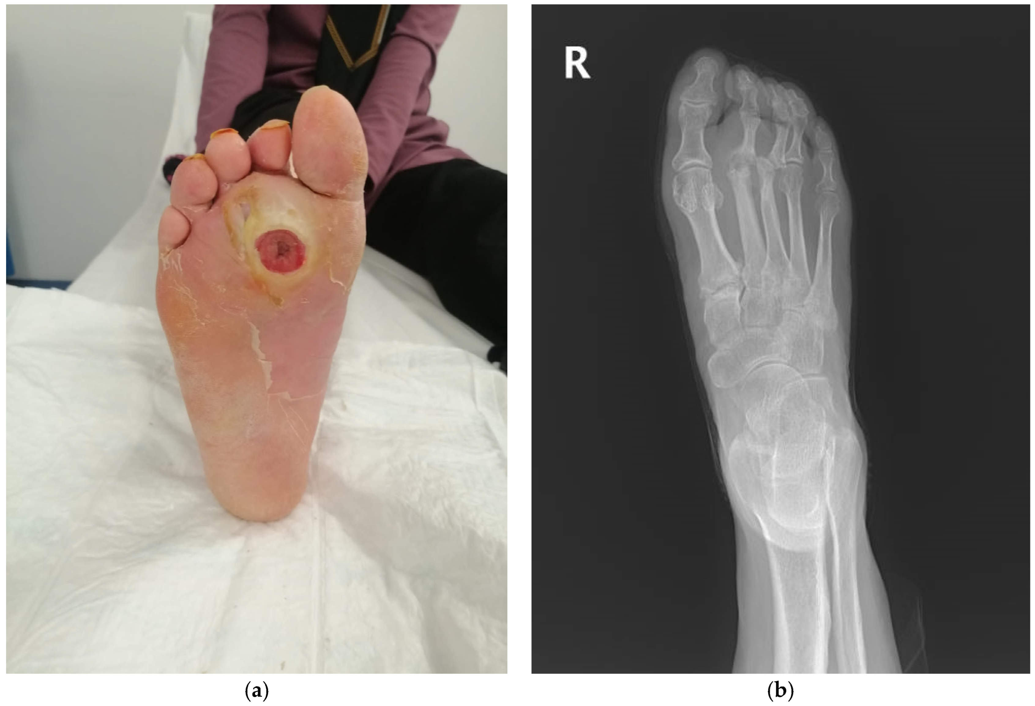 Diagnostics 15 00880 g002