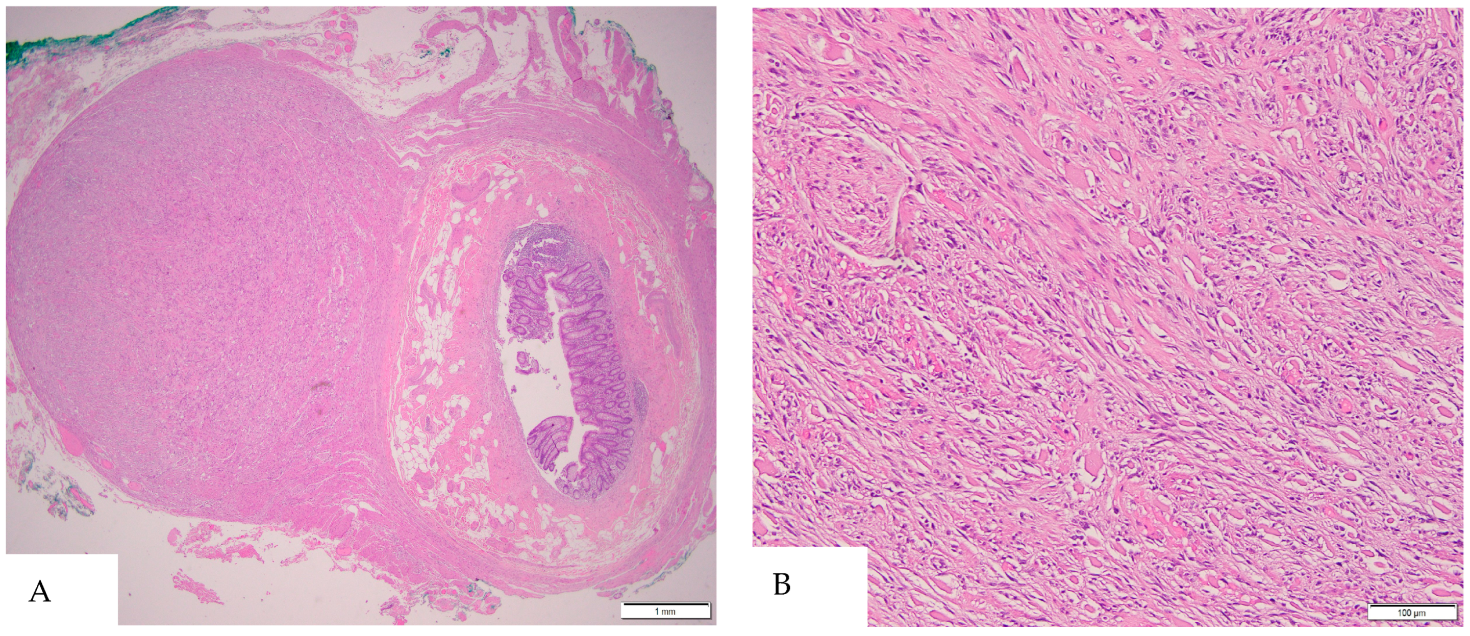 Diagnostics 15 00924 g001