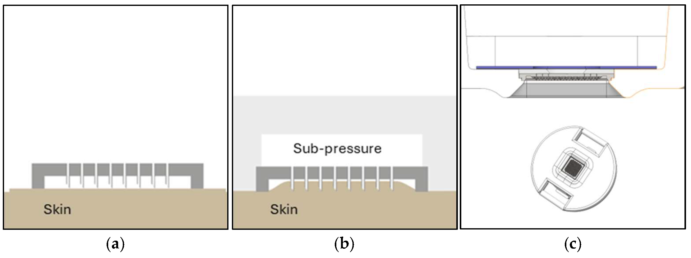 Diagnostics 15 00989 g003