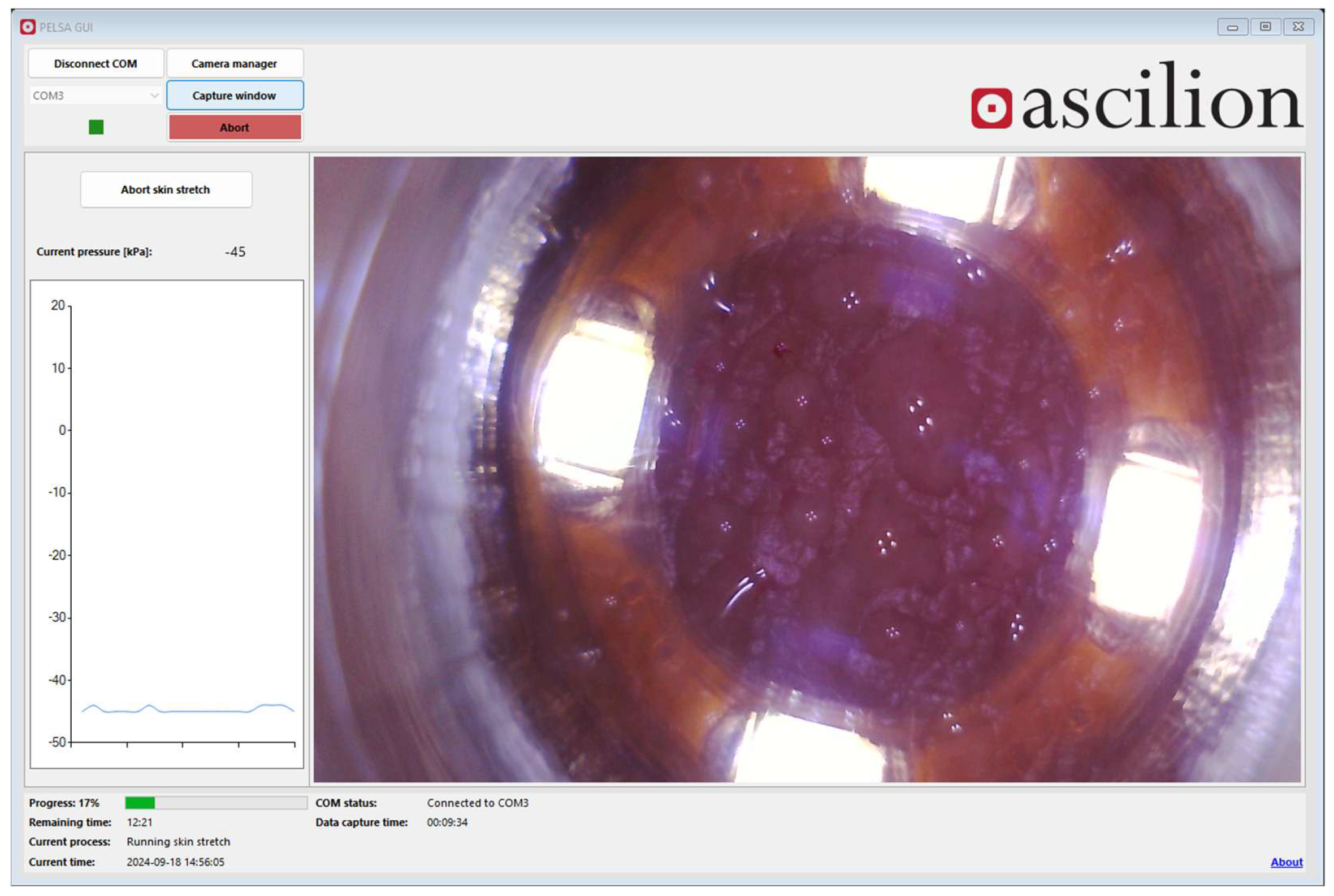 Diagnostics 15 00989 g011