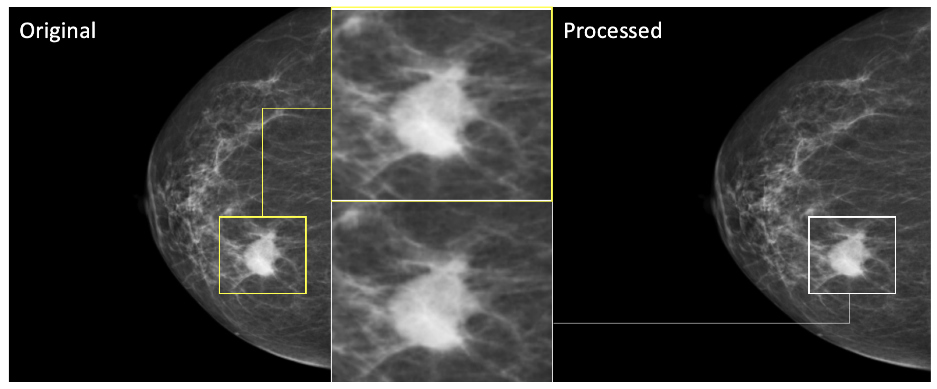 Diagnostics 15 00995 g003