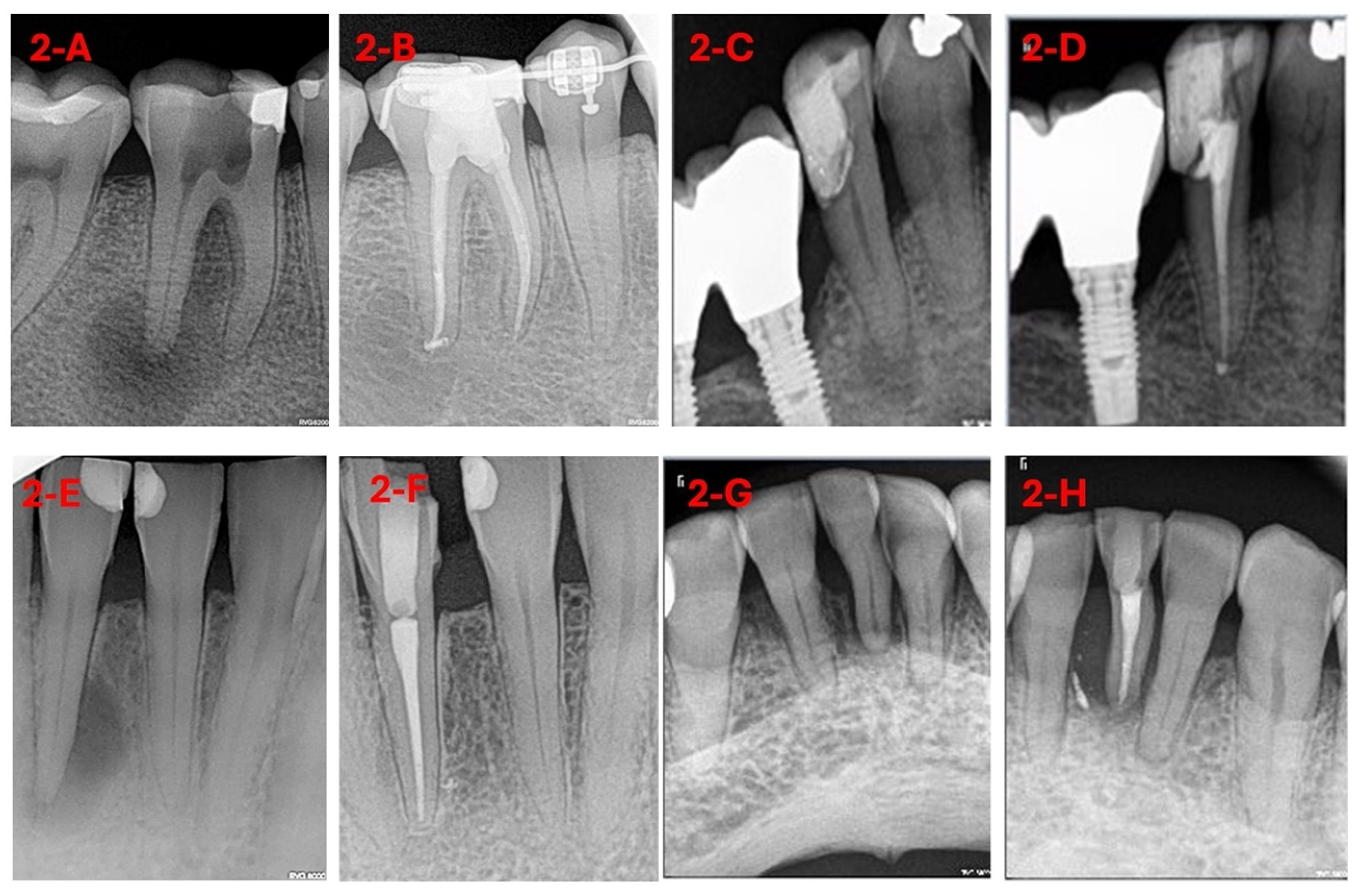 Diagnostics 15 01009 g002