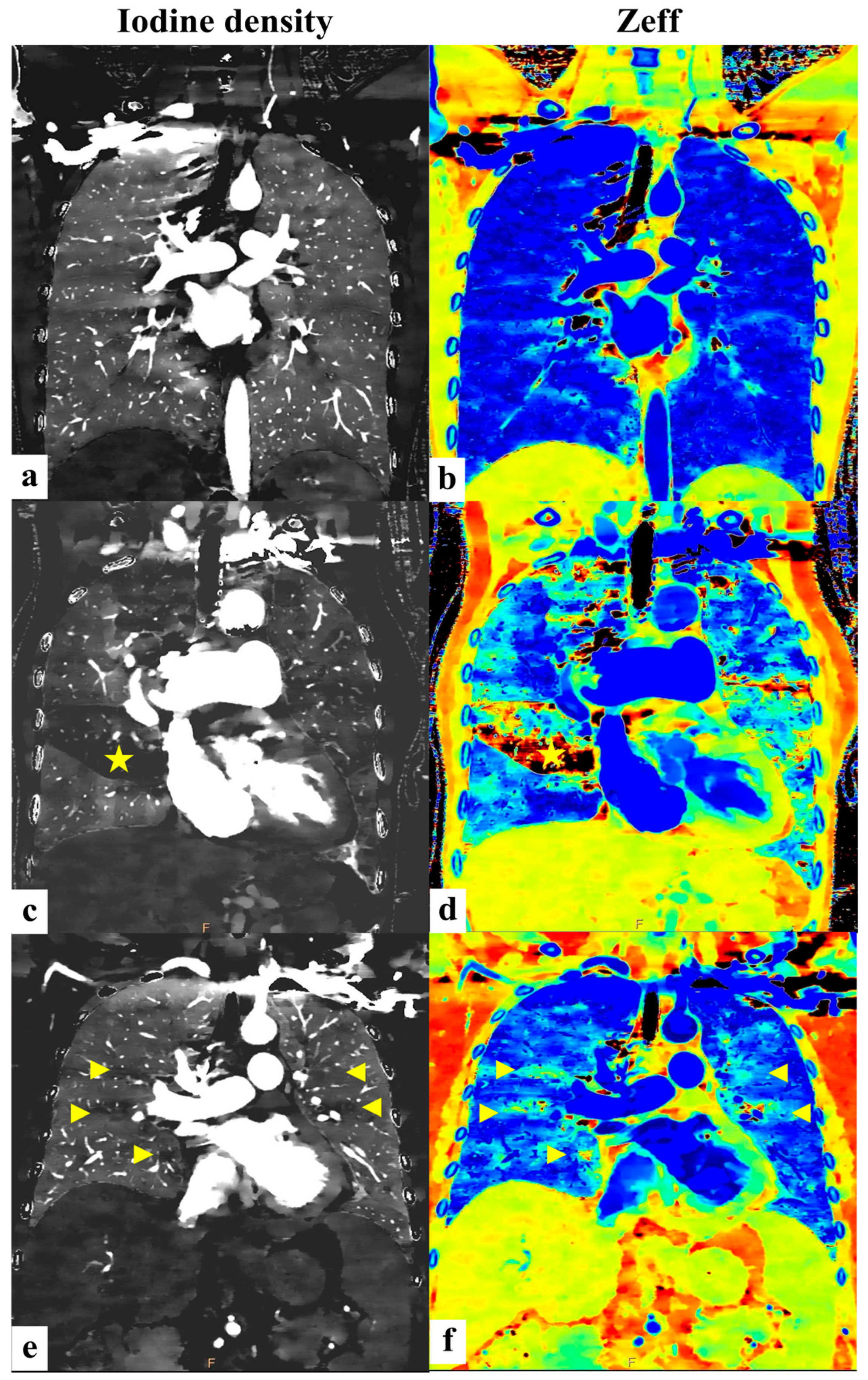 Diagnostics 15 01069 g005 Diagnostics 15 01069 g005