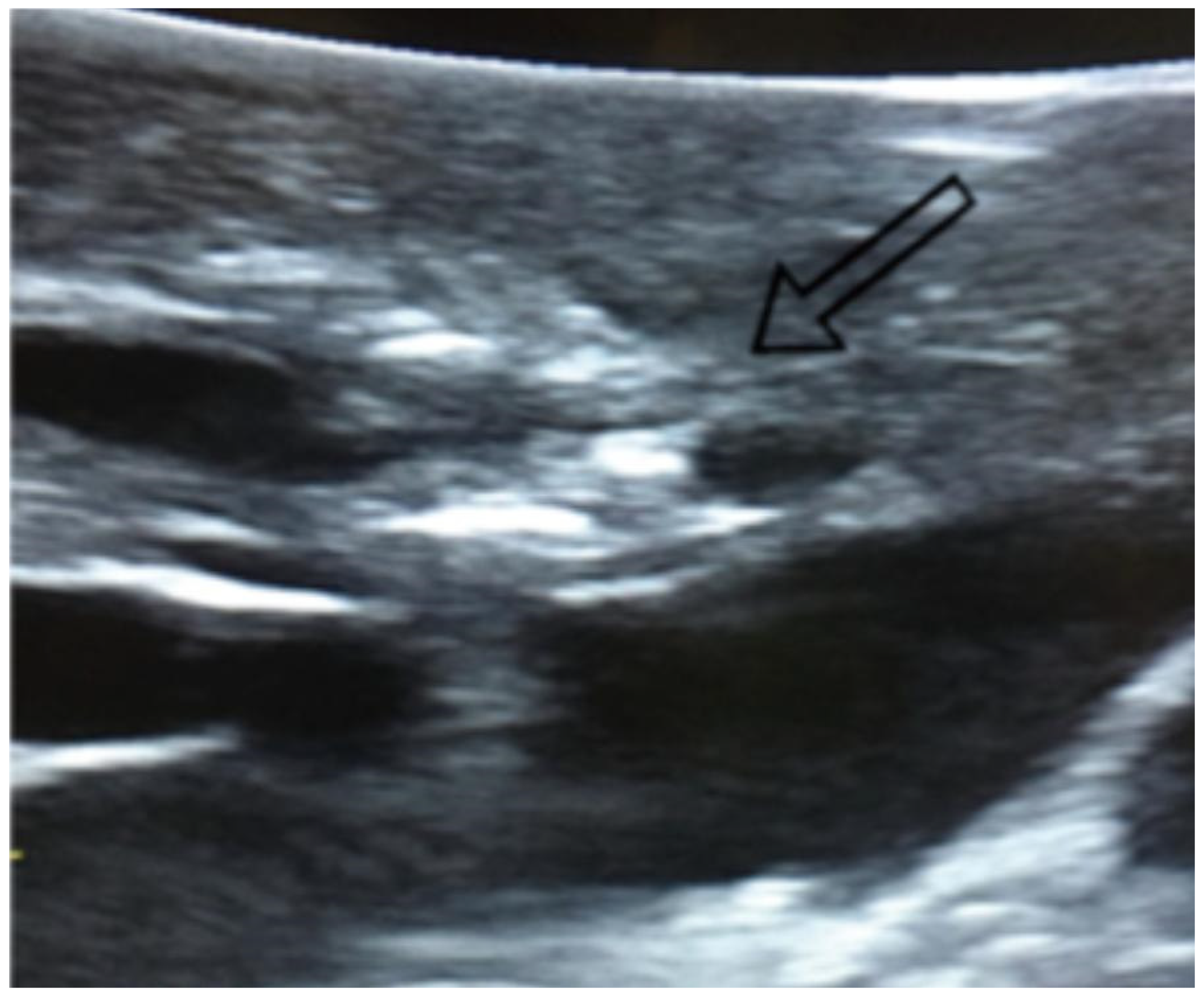 Diagnostics 15 01074 g001