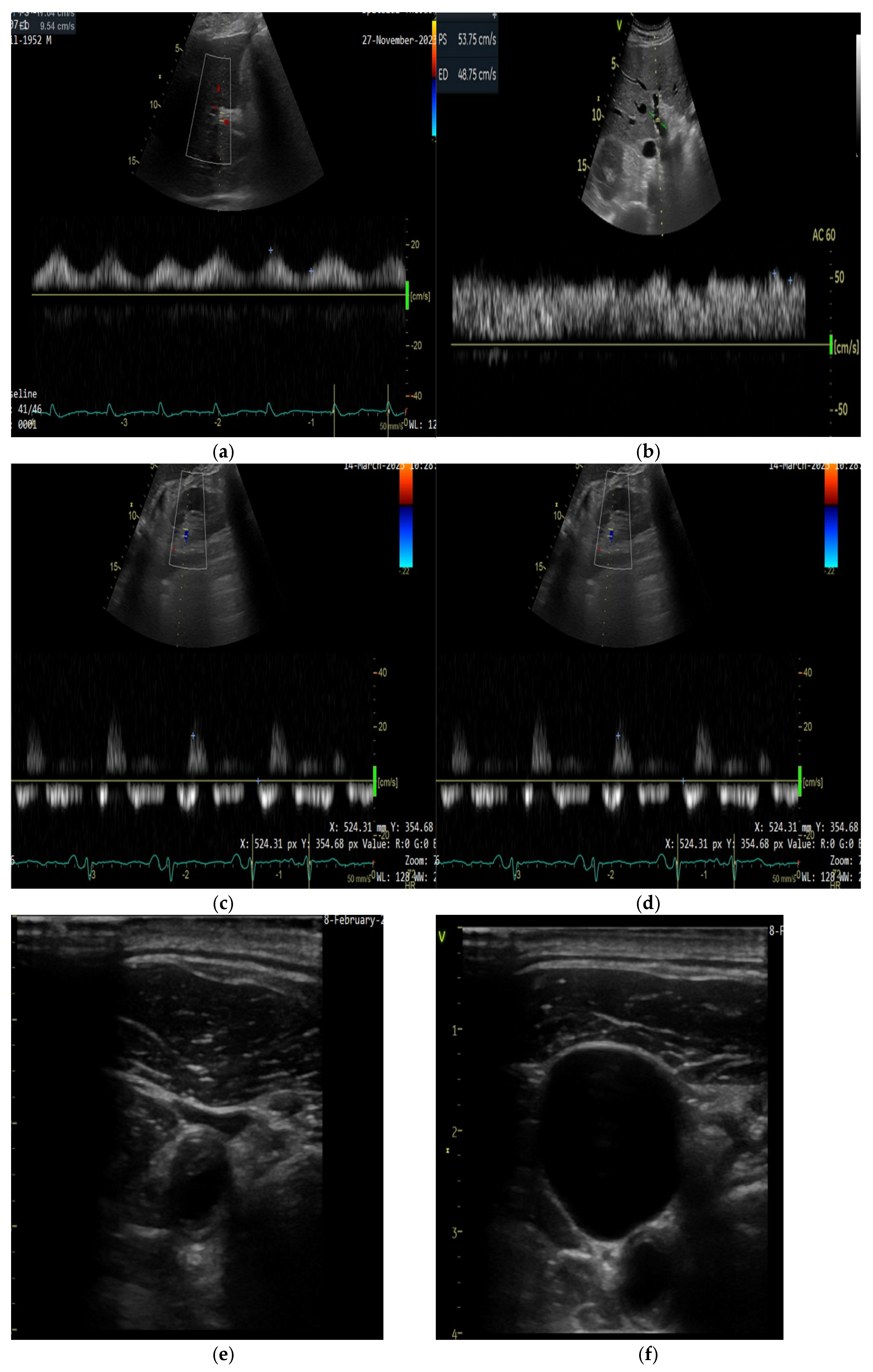 Diagnostics 15 01083 g001