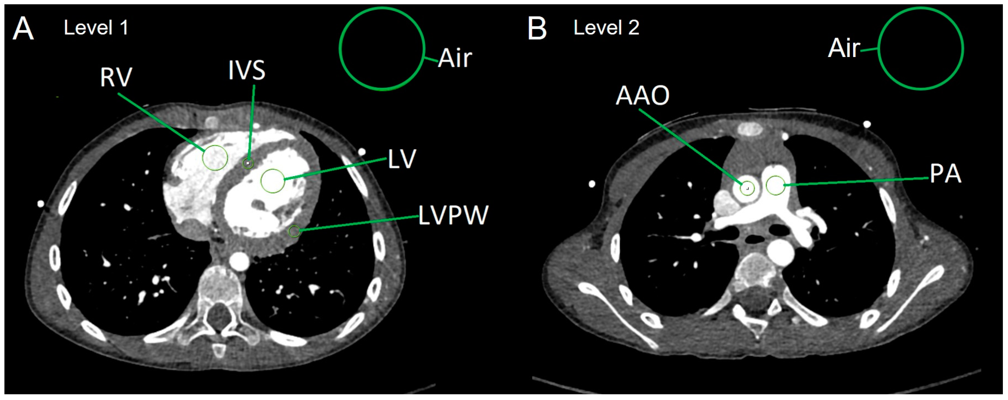 Diagnostics 15 01103 g001