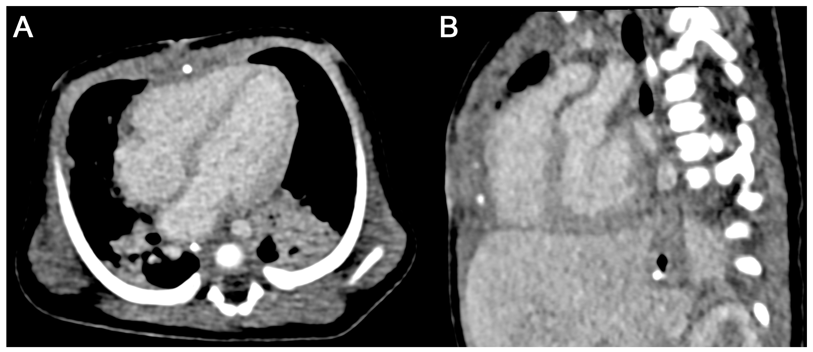 Diagnostics 15 01103 g004