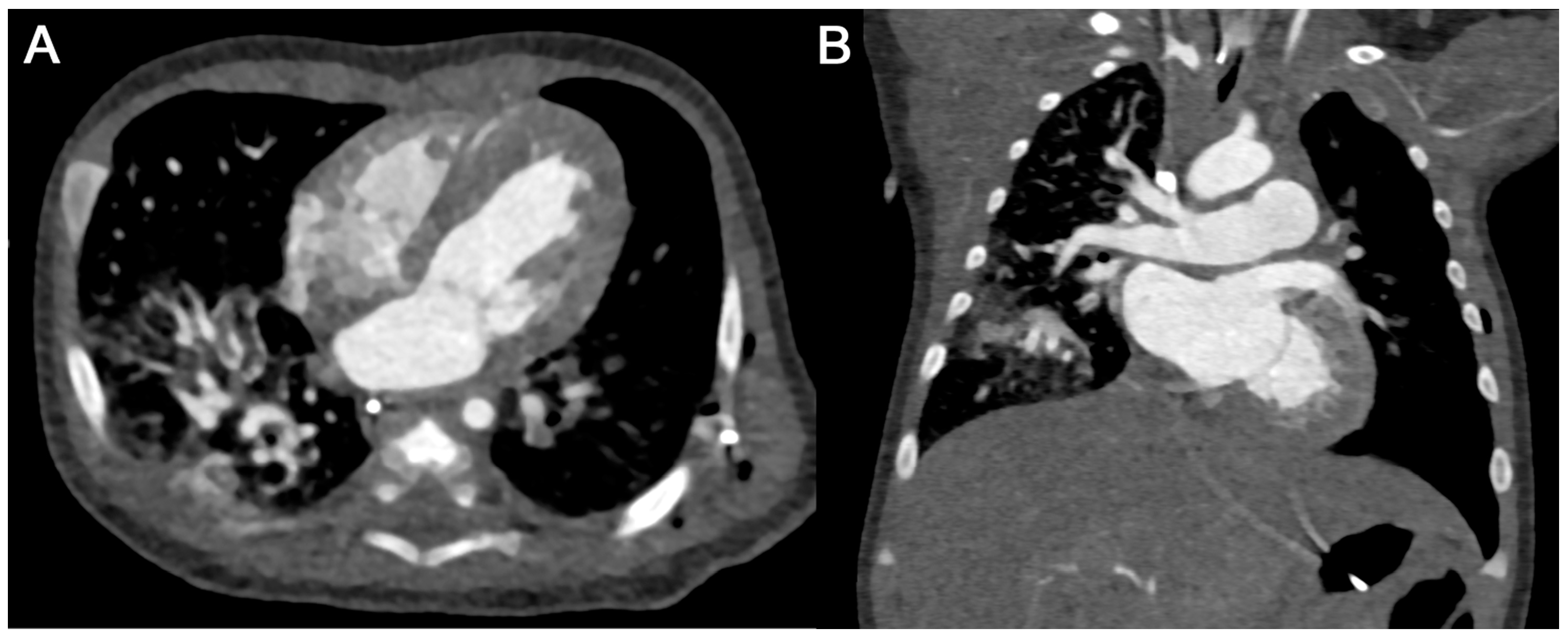 Diagnostics 15 01103 g007