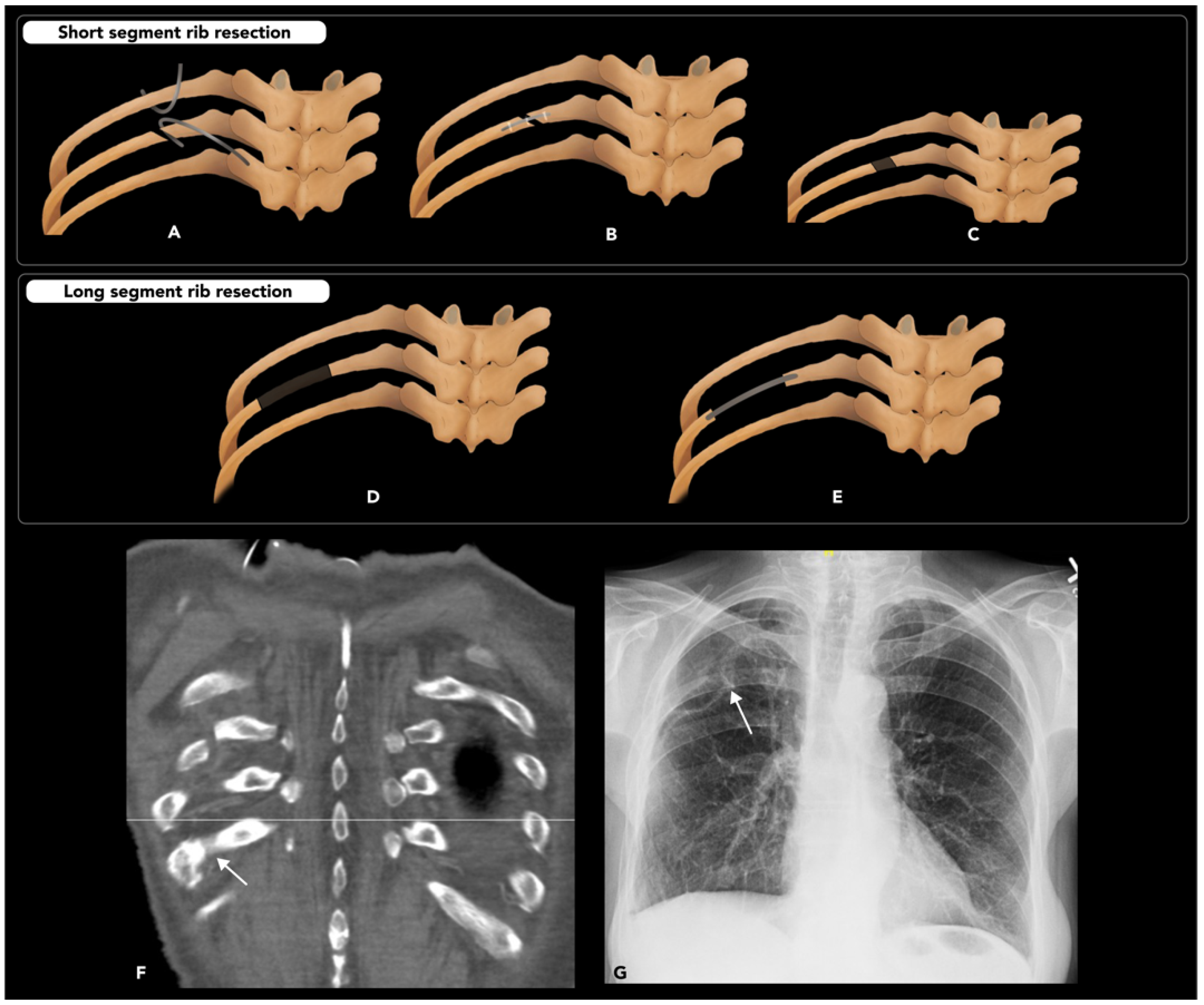 Diagnostics 15 01184 g017 Diagnostics 15 01184 g017