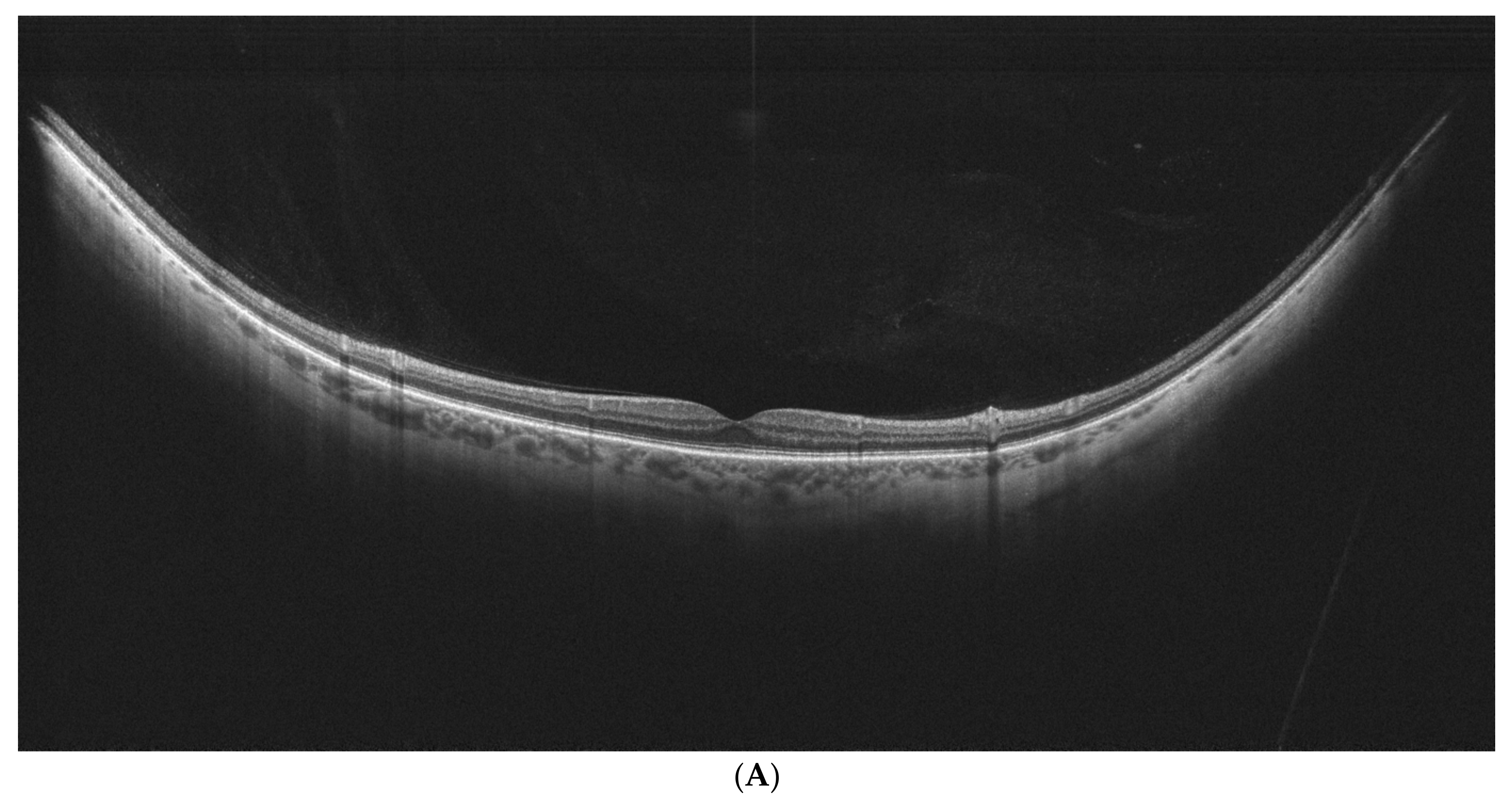 Diagnostics 15 01382 g002a