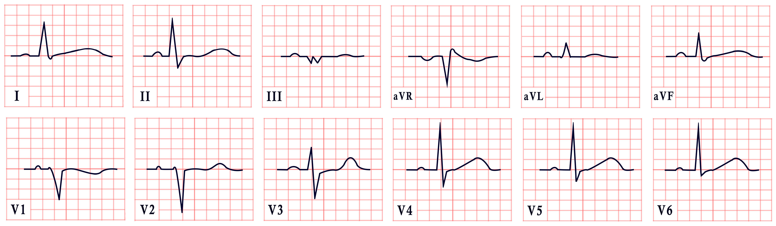 Diagnostics 15 01568 g002