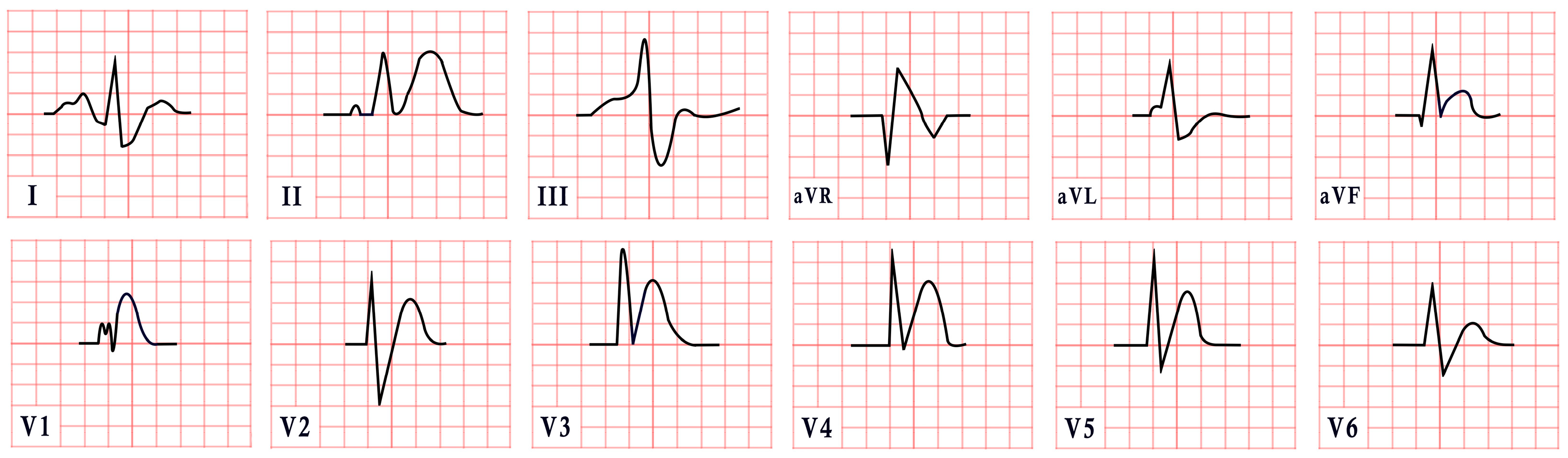 Diagnostics 15 01568 g006