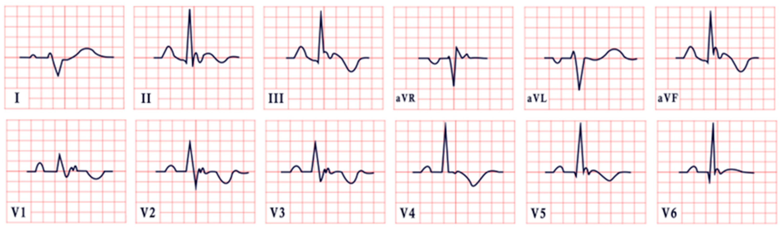 Diagnostics 15 01568 g013