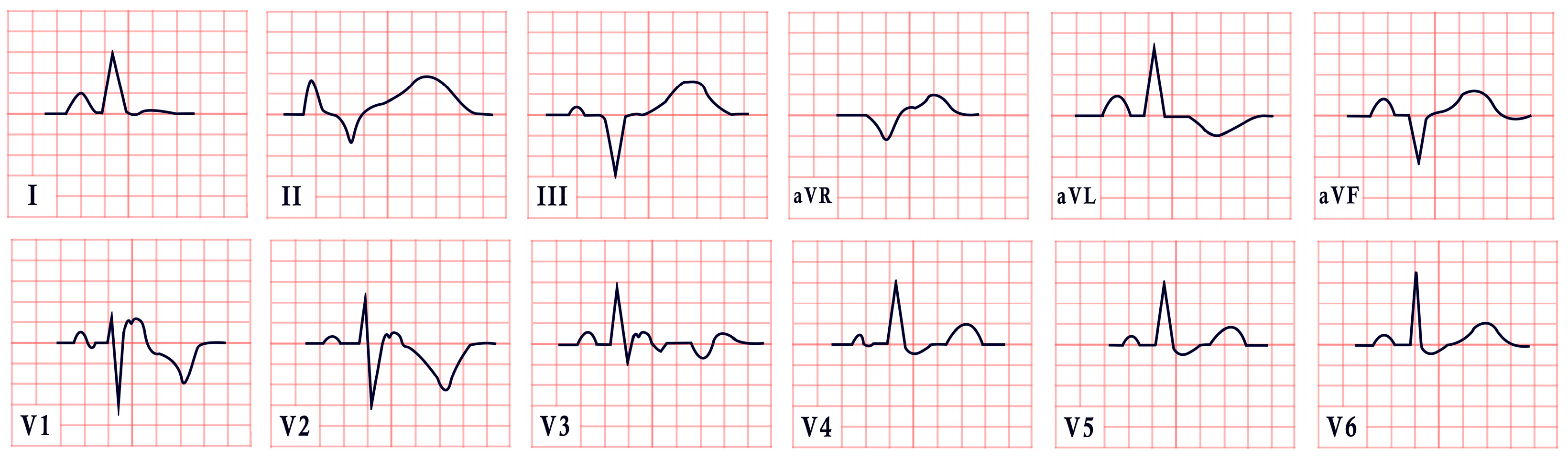 Diagnostics 15 01568 g014