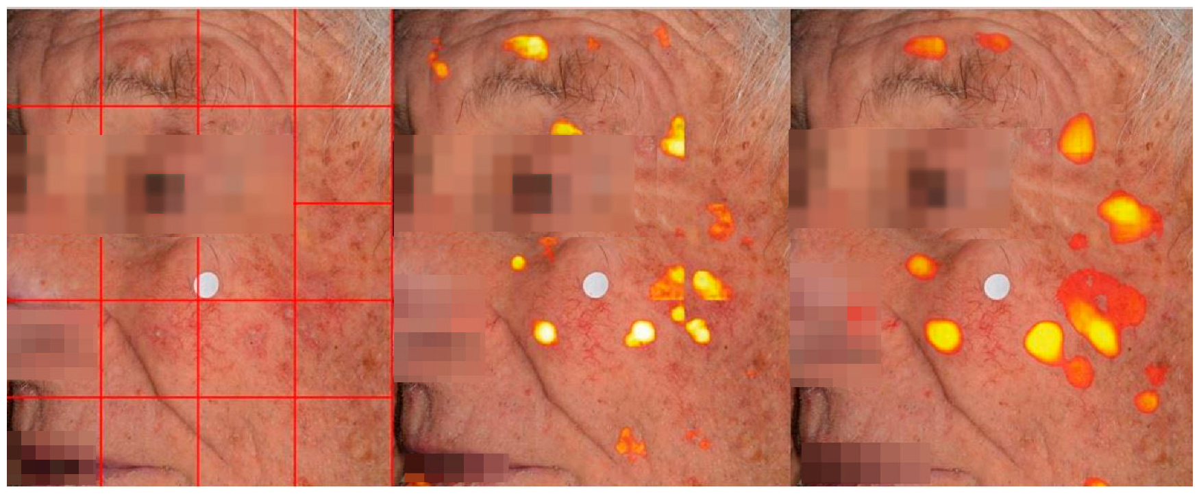 Diagnostics 15 01752 g004